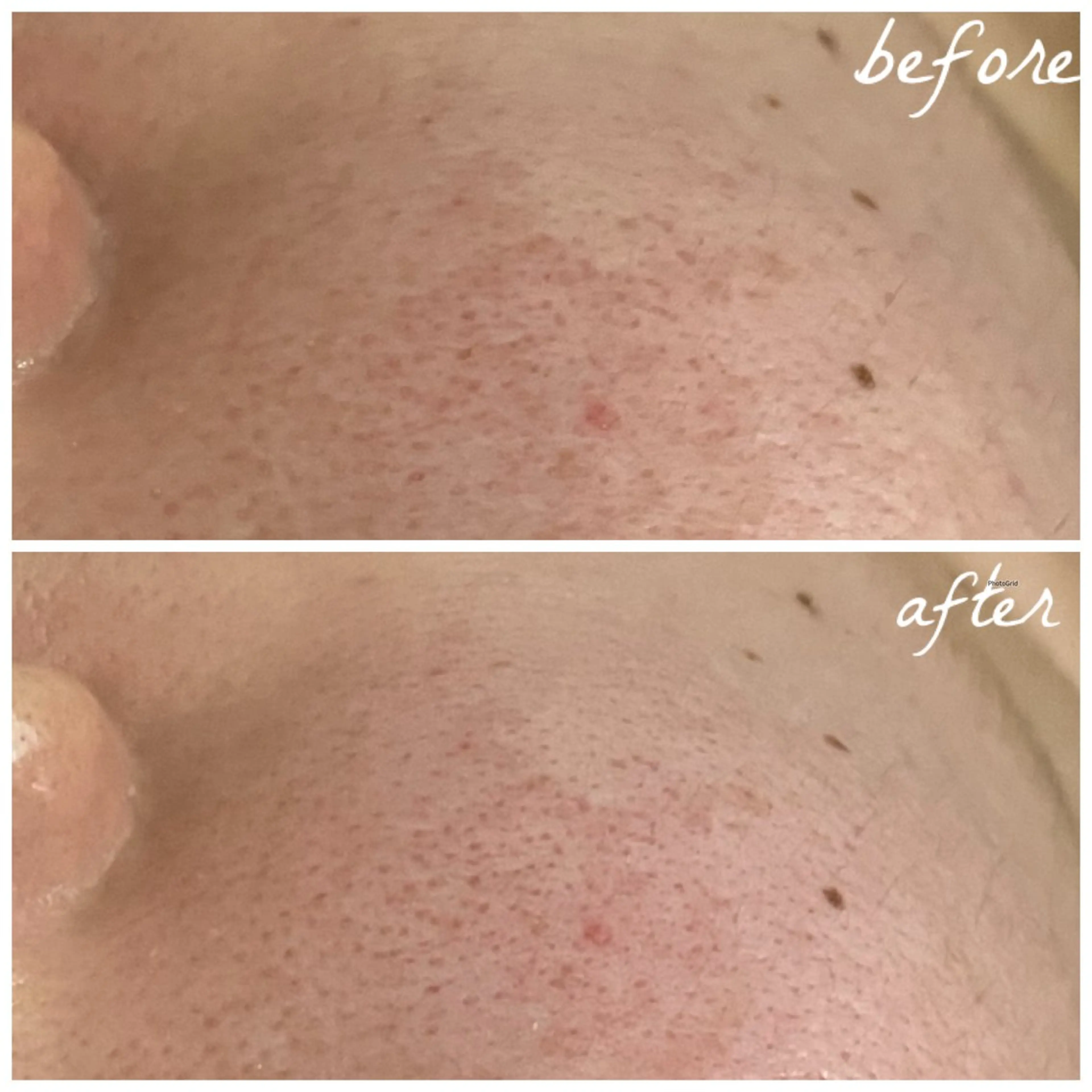 メンズ エステ メナード岐阜茜部 杉浦のエステ・リラクイメージ