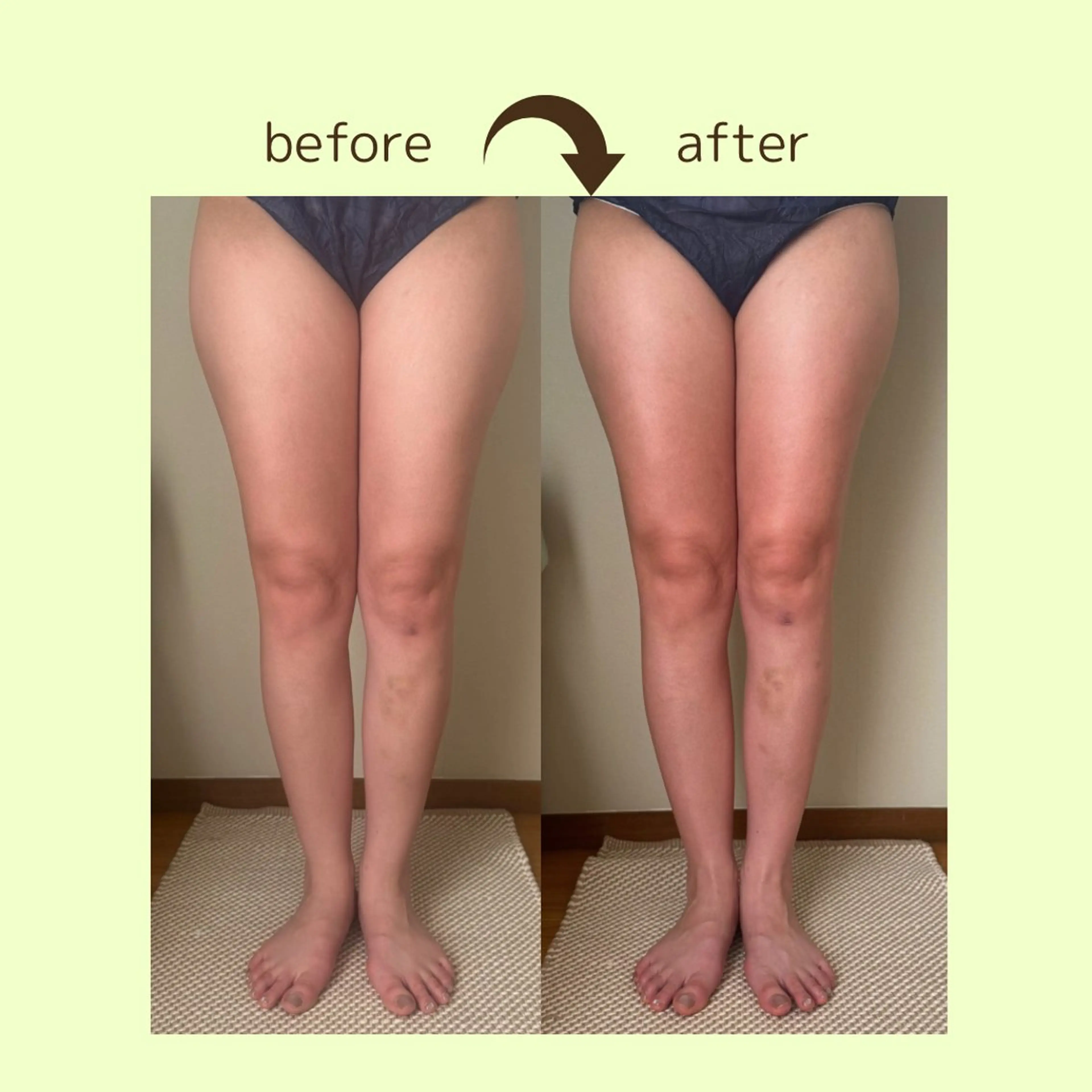 リラクゼーションスパ　ひのき所属・spaHINOKI 【女性専用】のエステ・リラクイメージ