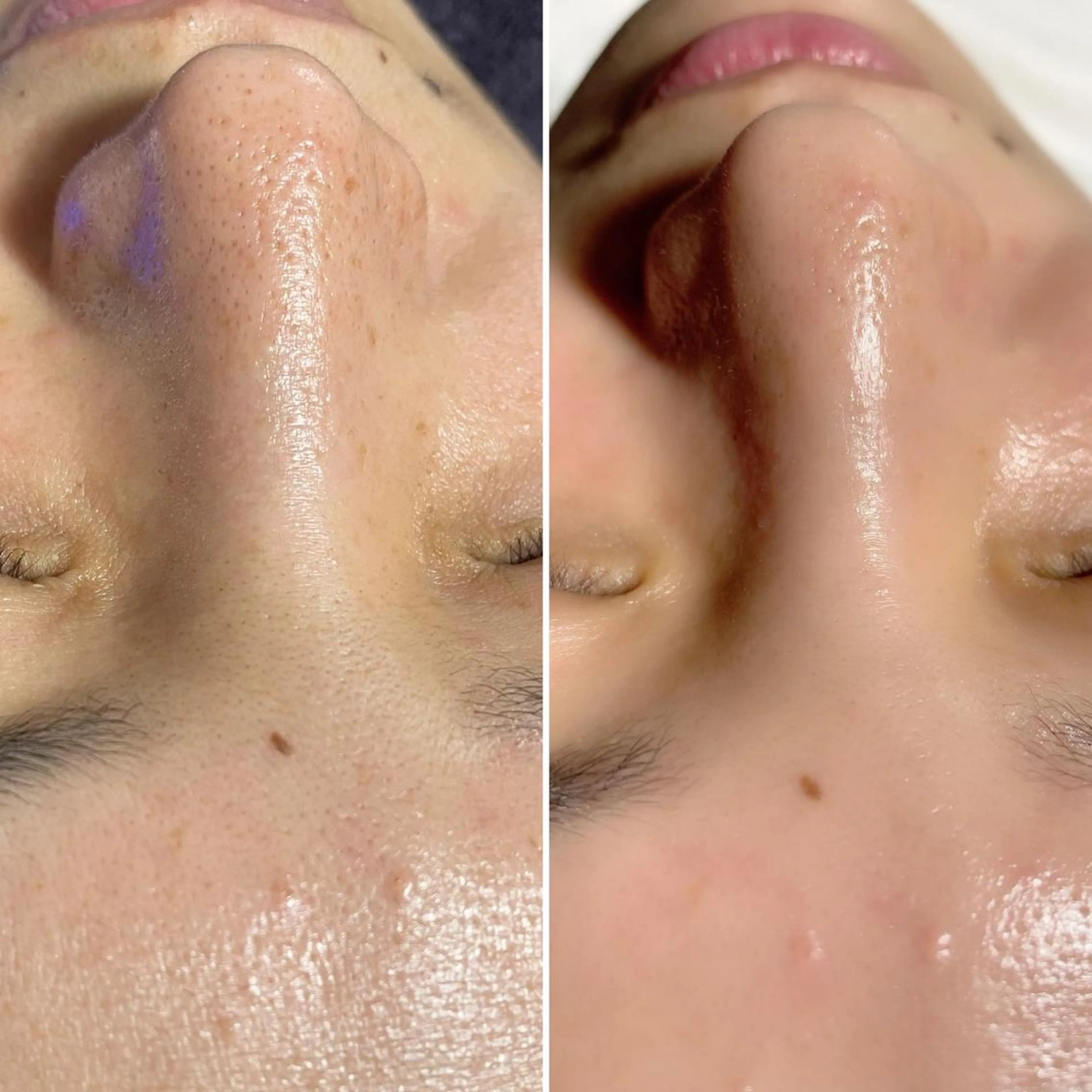 SESUNNY セサニー SEIRAのマツエク・マツパデザイン