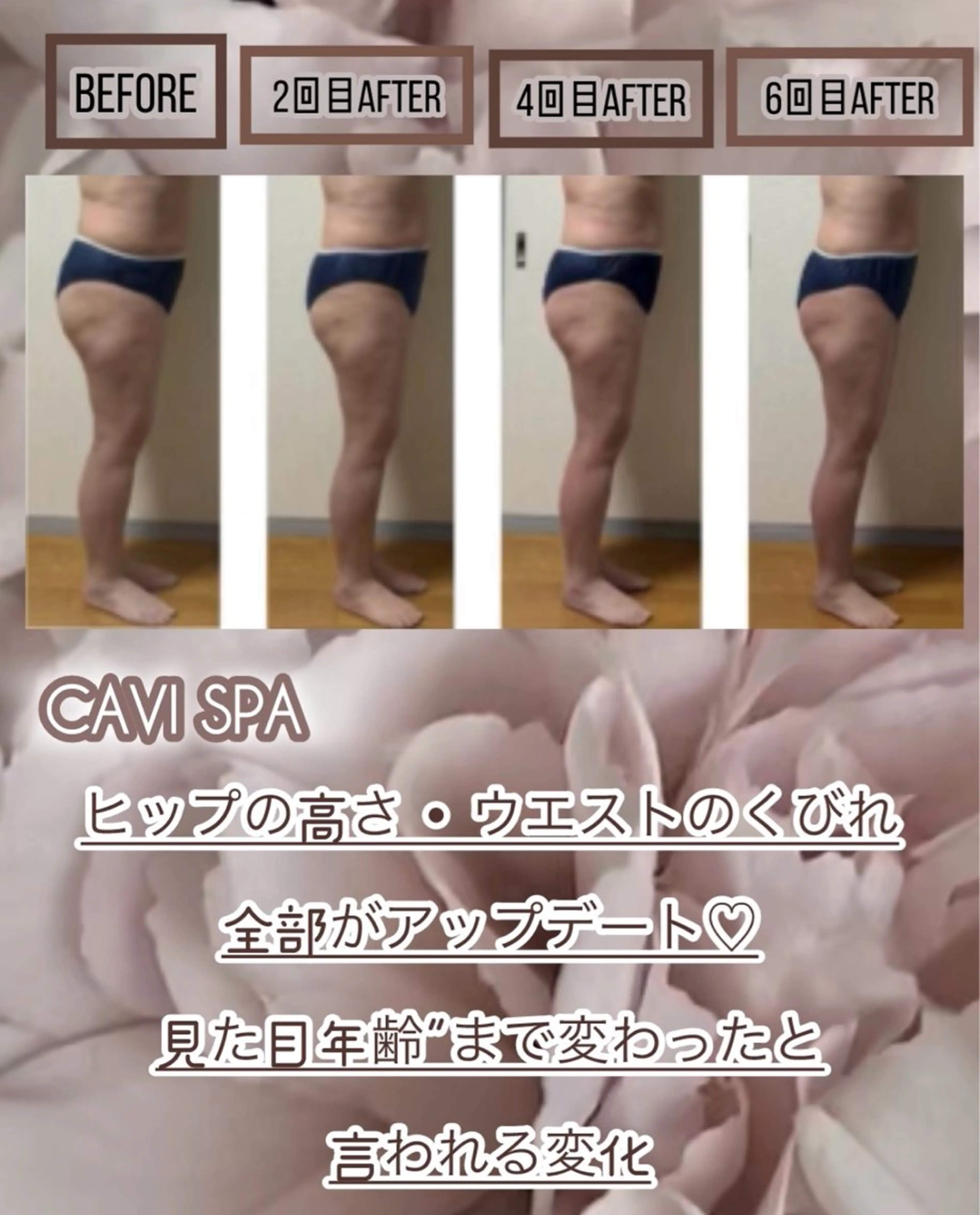 エステ ヴィーナス ビューティーのエステ・リラクイメージ