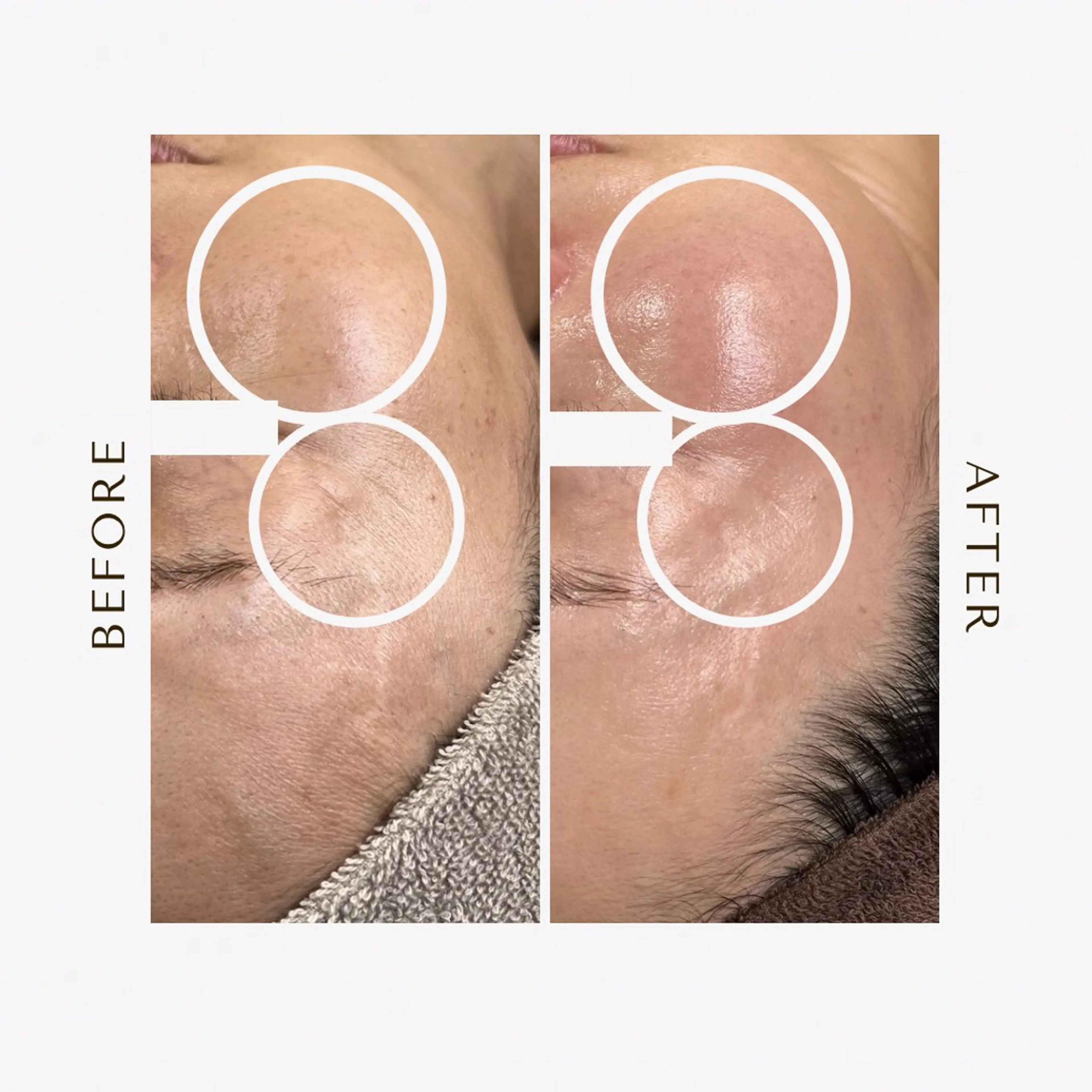 エステ 1st｜フェイシャル エステ専門店のエステ・リラクイメージ