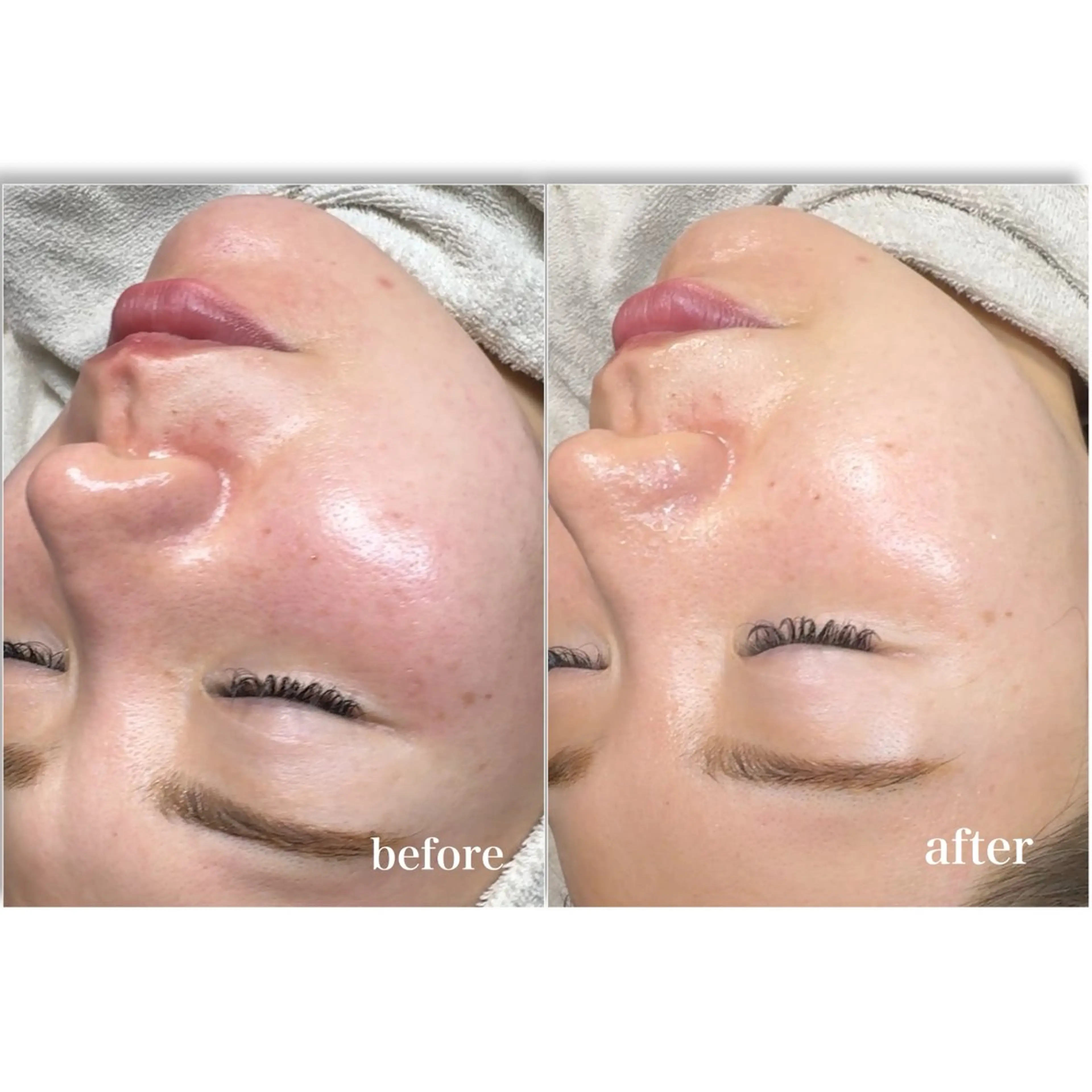 エステ yuuri. Sの眉毛・アイブロウイメージ