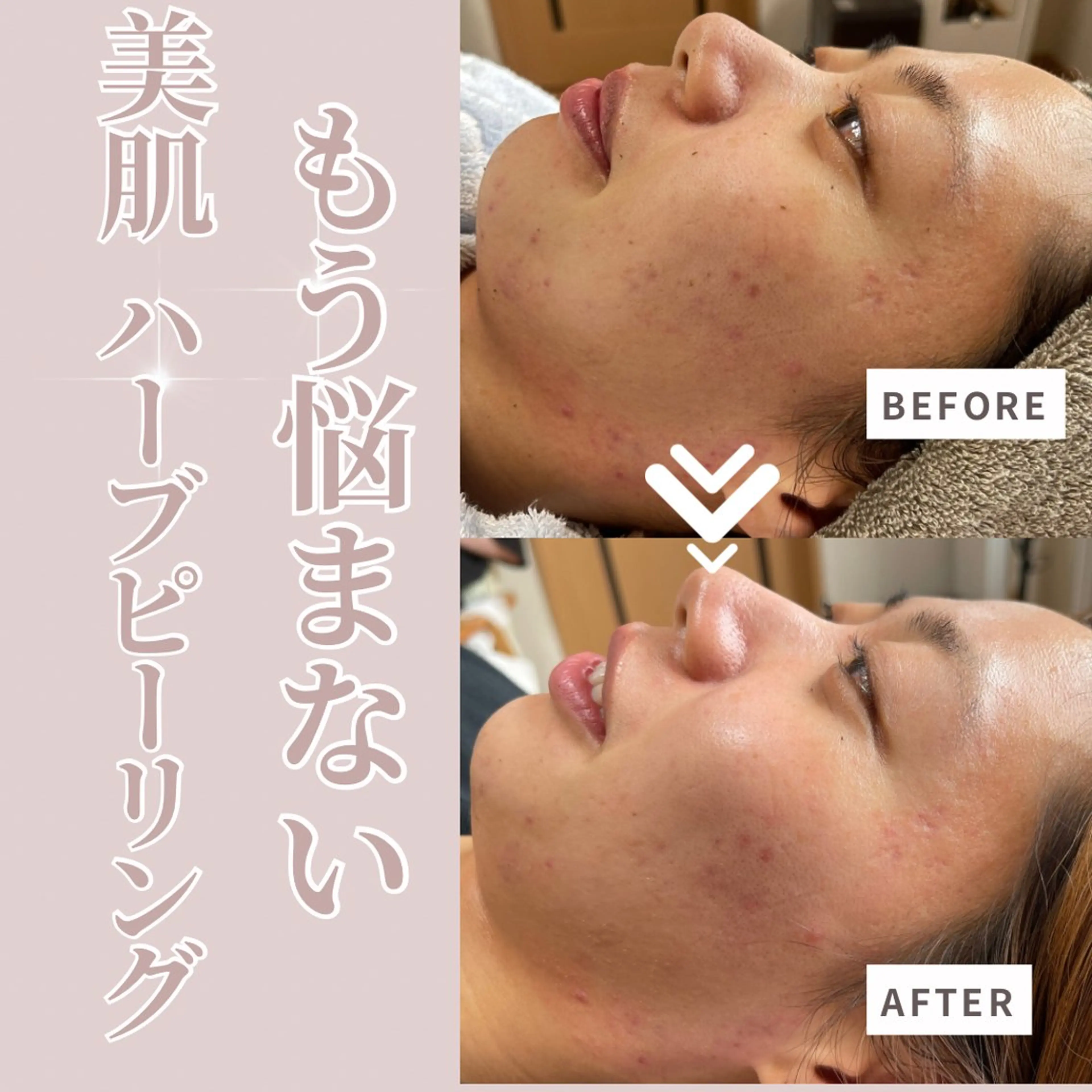 Liberte リベルテ(トモ化粧品店内)所属・RINA 🍒のマツエク・マツパデザイン