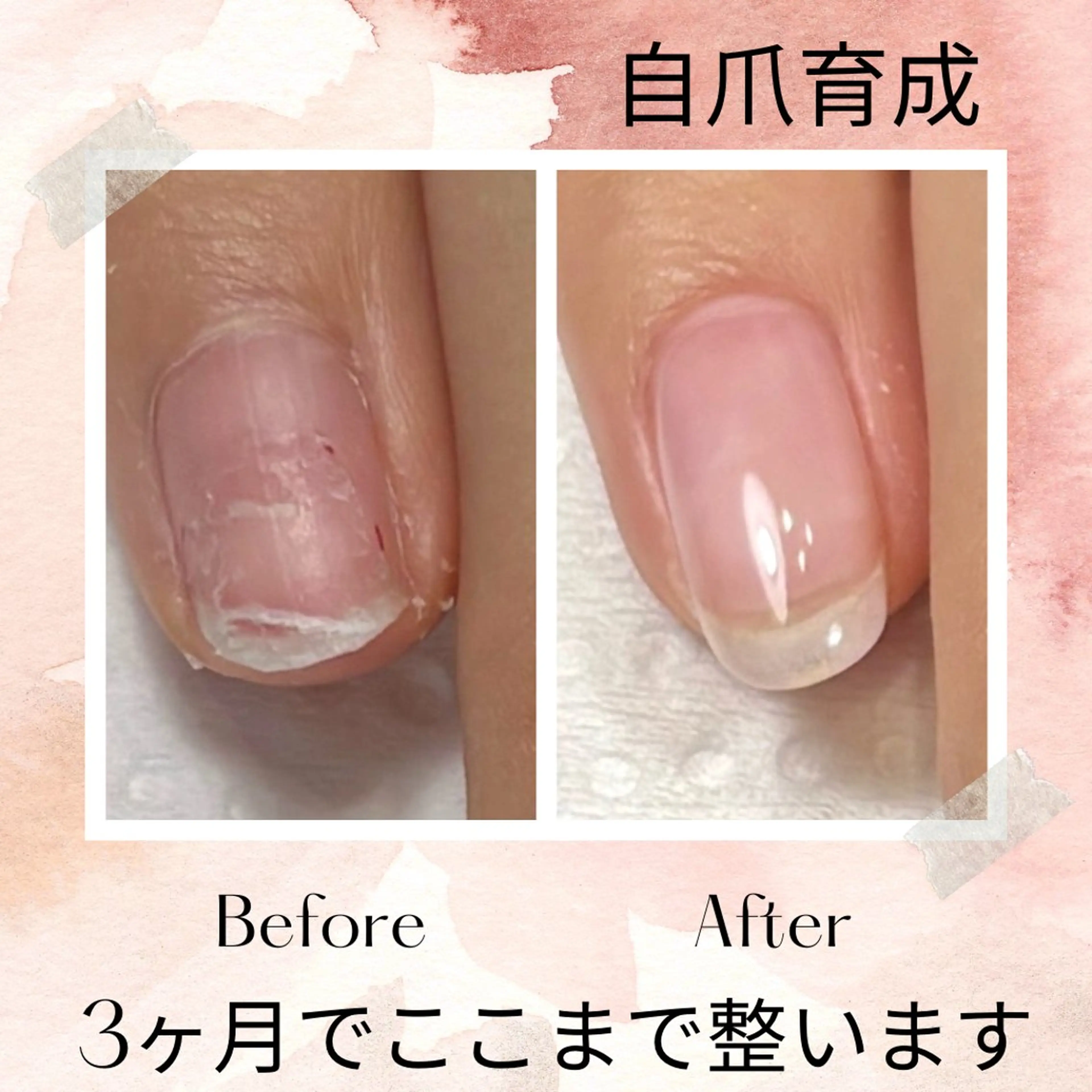 ネイル ハンドネイル ハンドケア 自爪育成 Keshlyのネイルデザイン