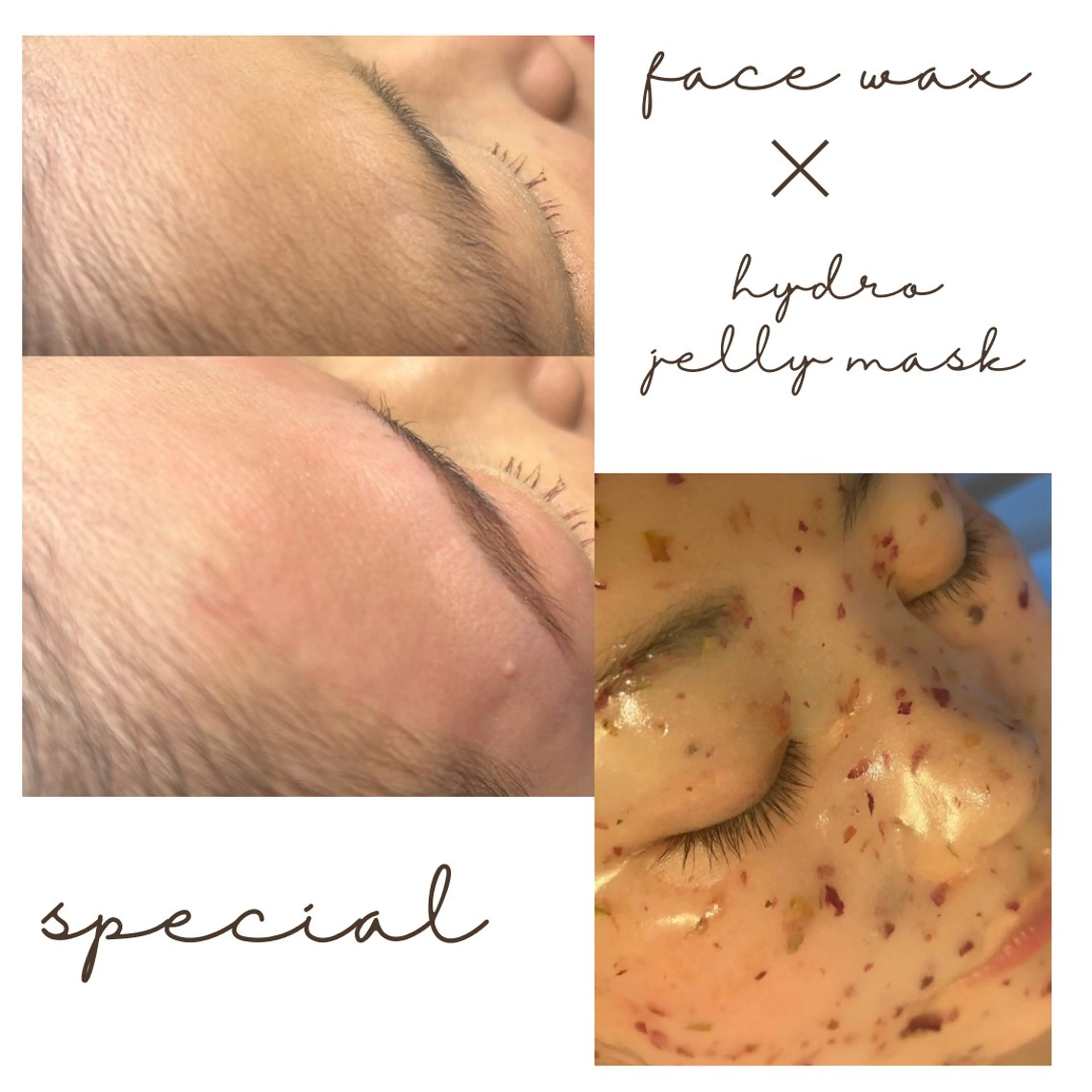 ⛓️全顔WAX ➕ハイドロジェリーマスクでのうる艶🥚の写真