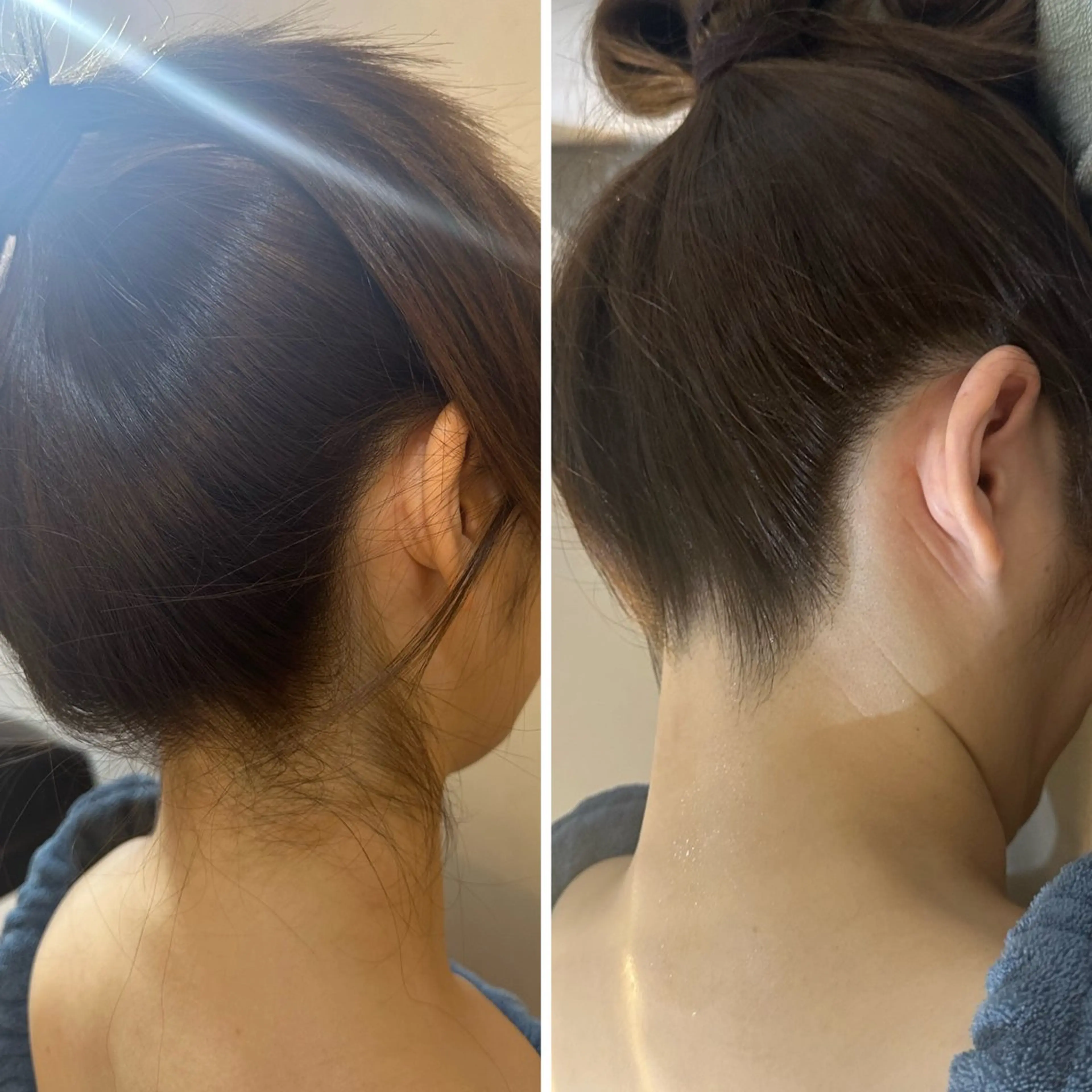 脱毛 うなじ脱毛/美肌脱毛 LABELのエステ・リラクイメージ