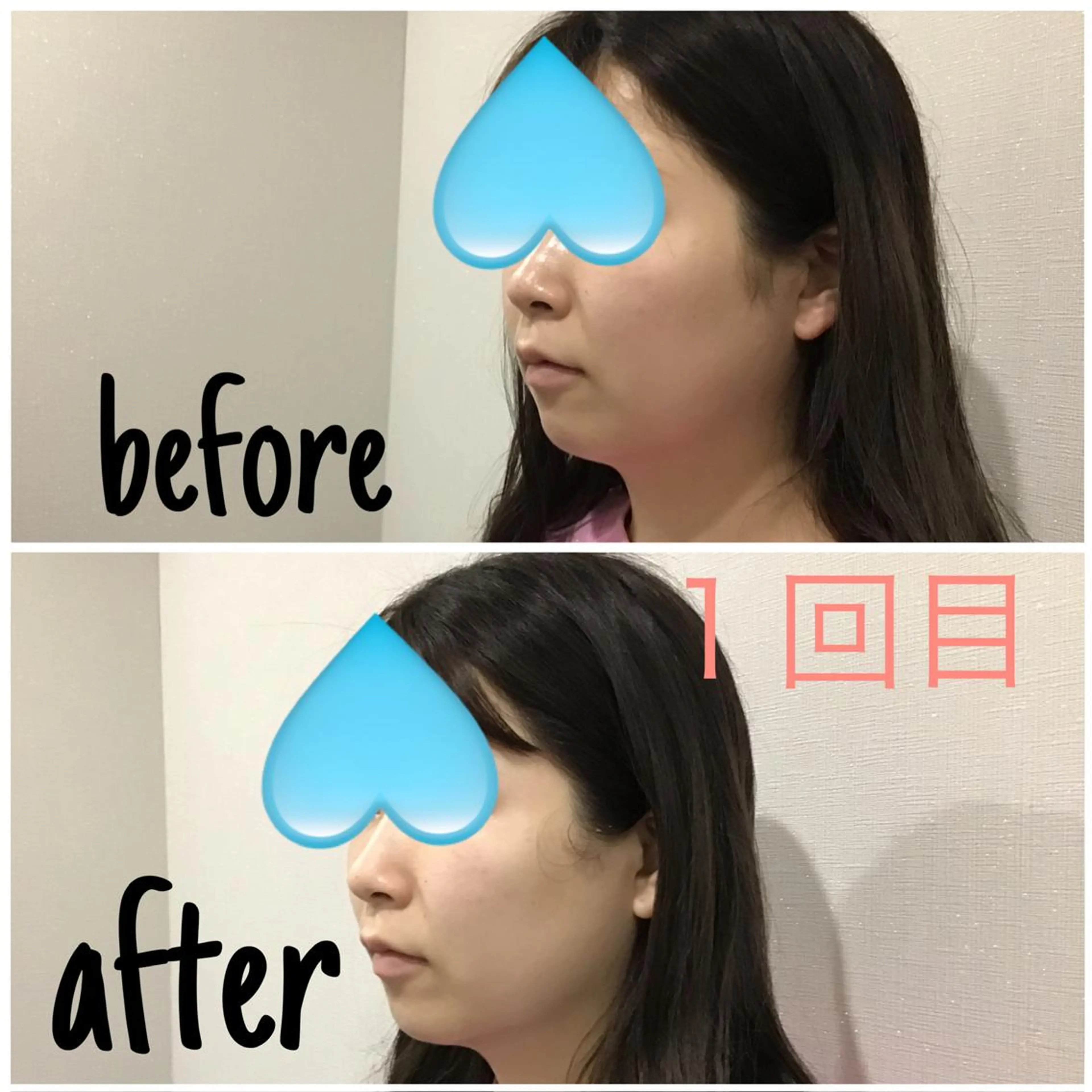 アルカンジュ~archange~所属・痩身/毛穴洗浄/脱毛 アルカンジュのエステ・リラクイメージ