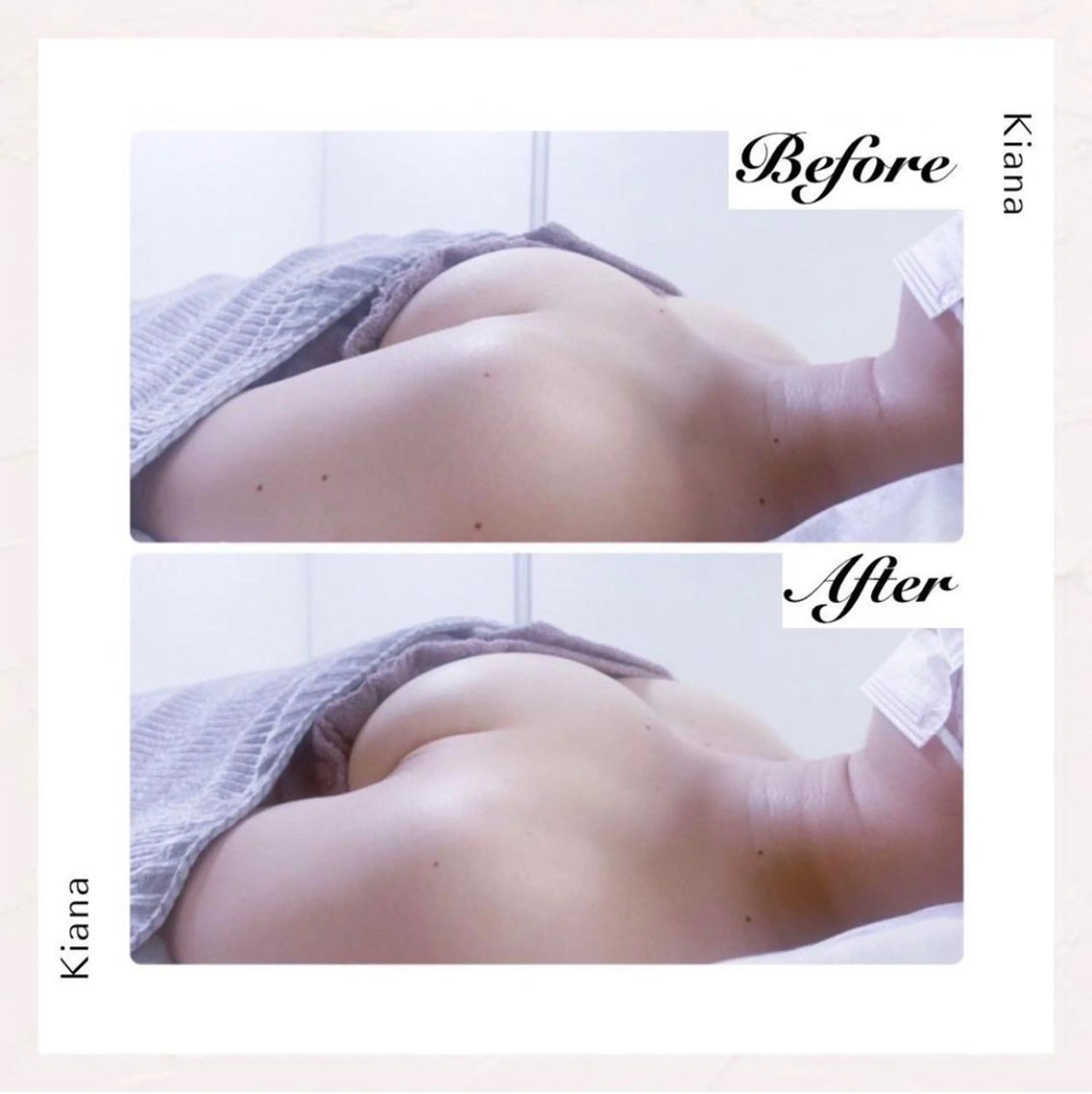 エステ リラク バスト専門Kiana 風のエステ・リラクイメージ