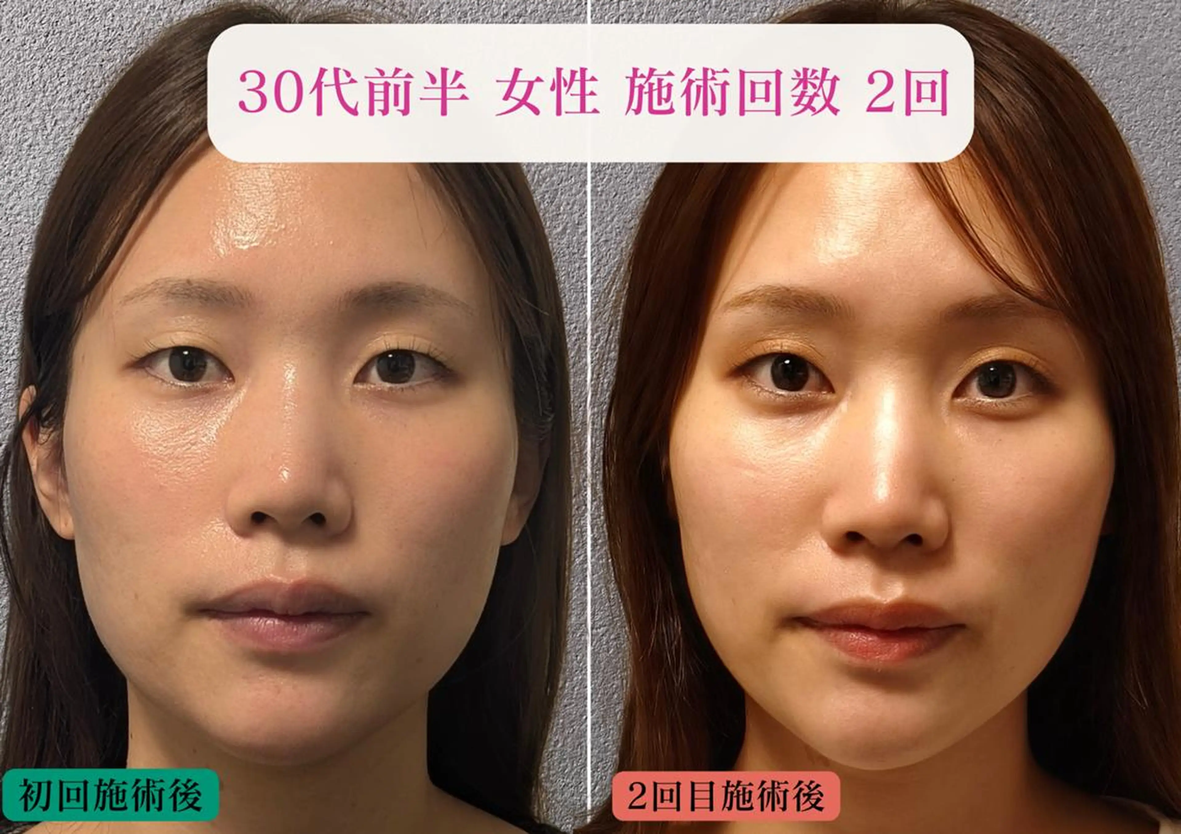 美容とカラダの鍼灸 サロン やなけんのエステ・リラクイメージ