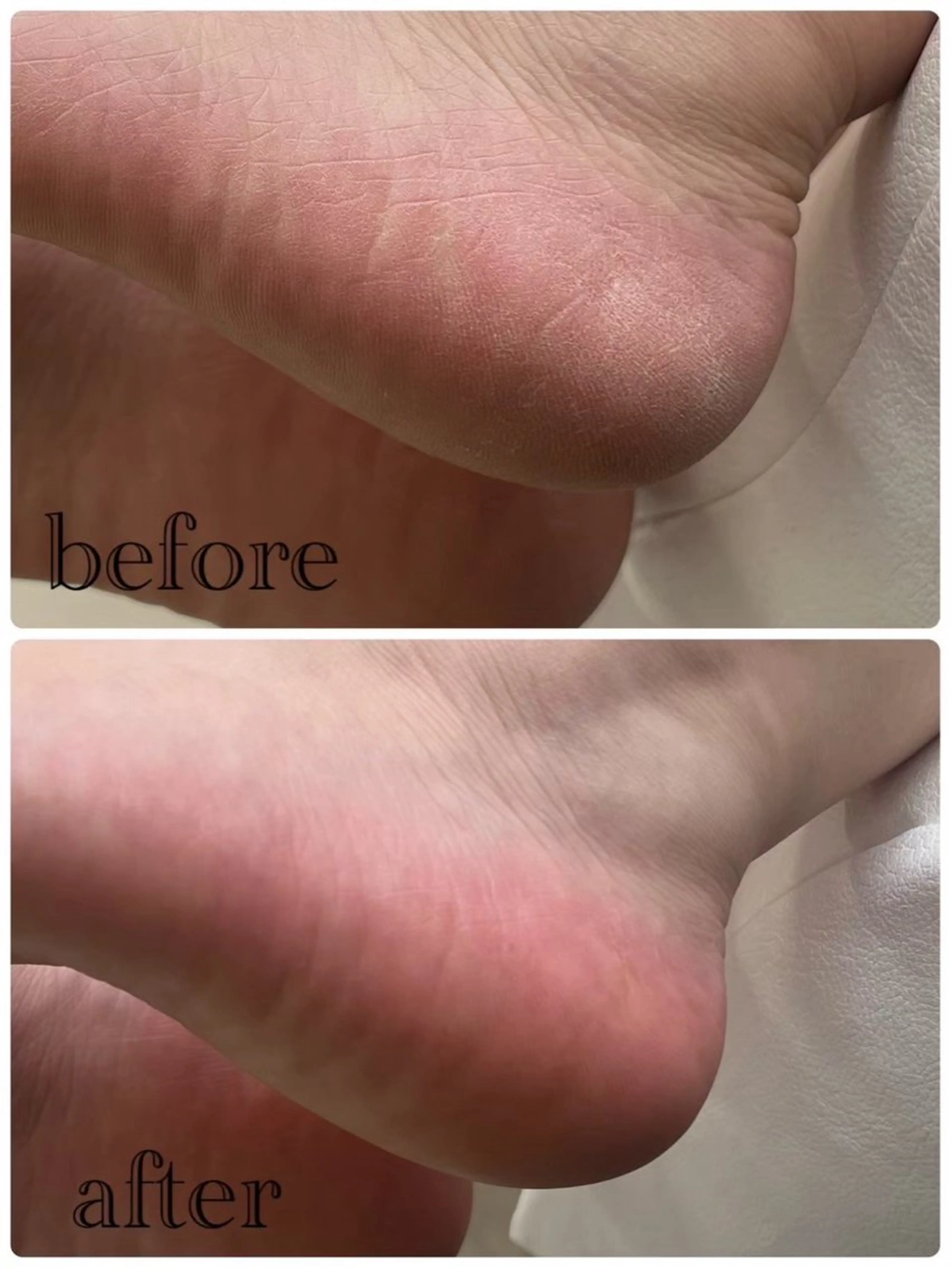 Tesoro.所属・プライベートサロン Tesoro.の眉毛・アイブロウイメージ