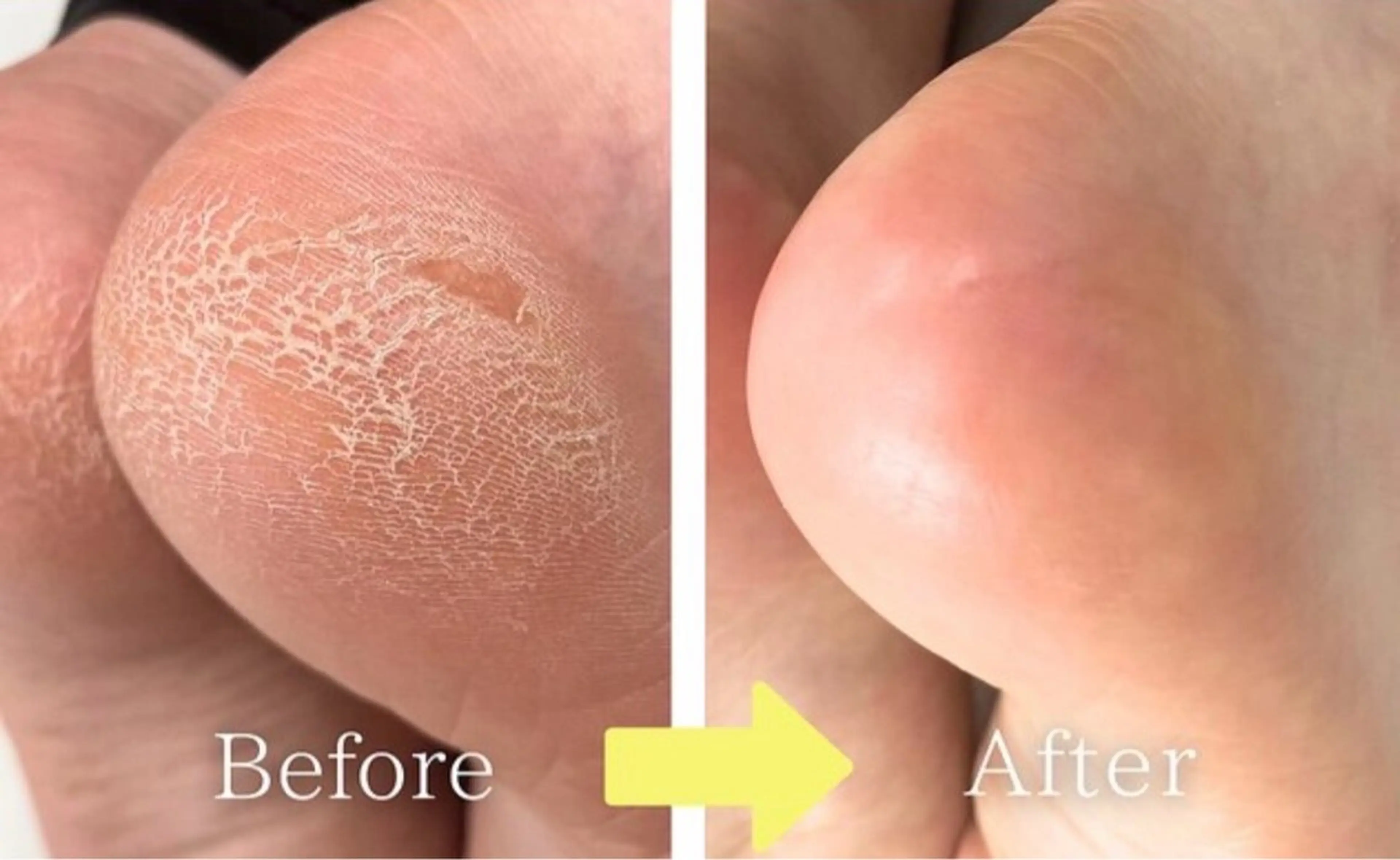 ネイル flanfika/ 吉原のマツエク・マツパデザイン