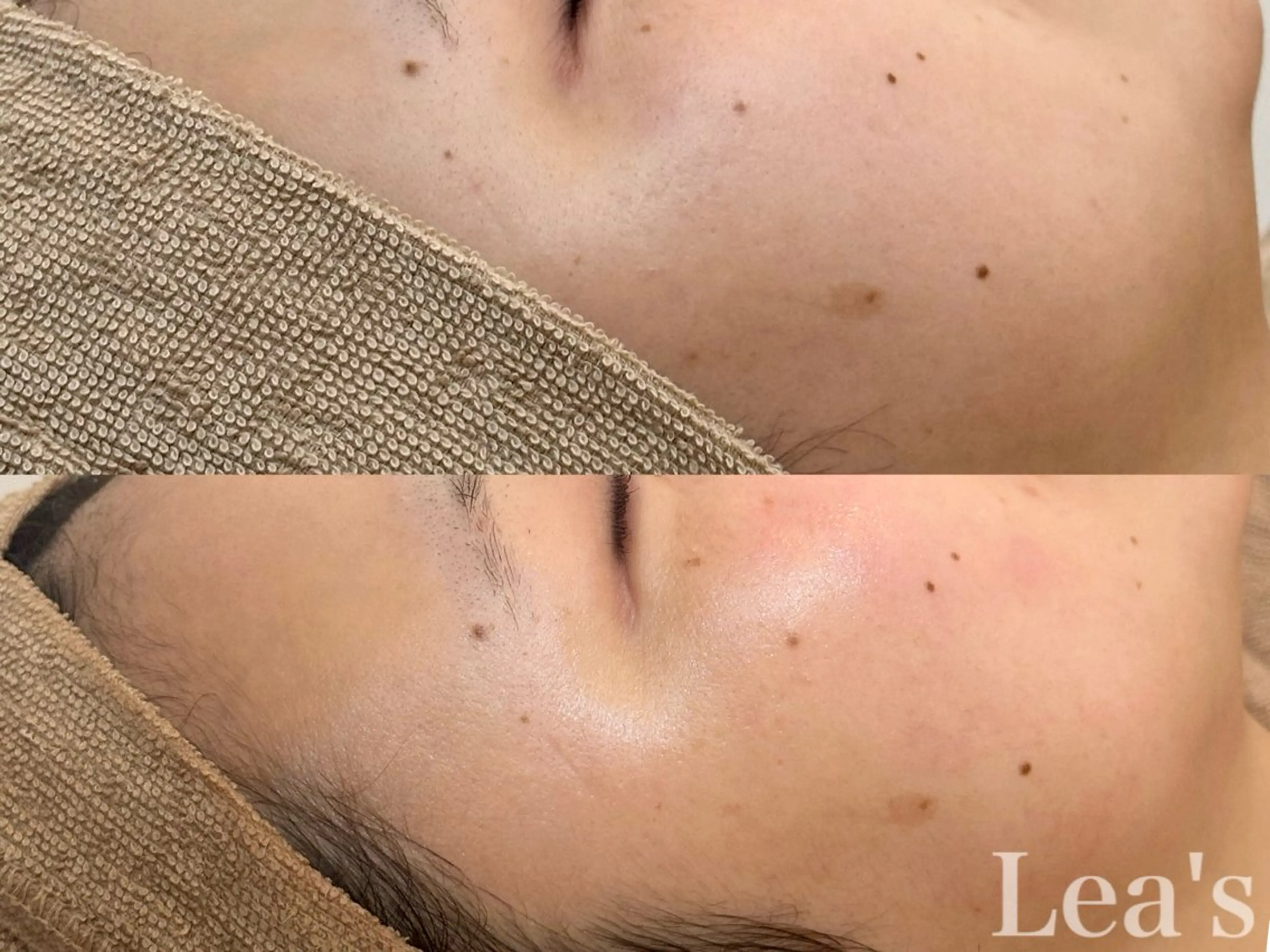 Lea's所属・【Lea's 】 hazukiのエステ・リラクイメージ