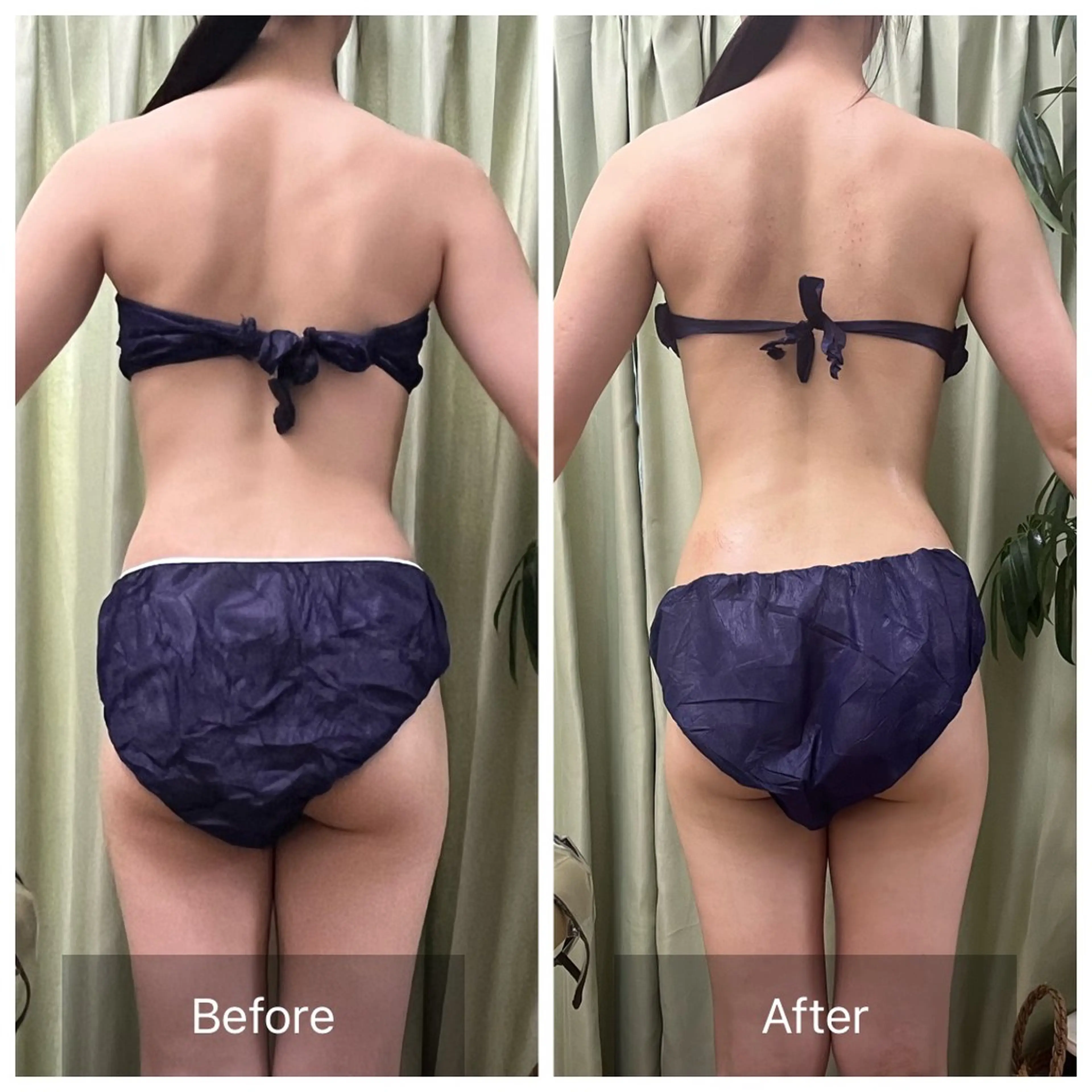 エステ リラク 【元に戻らない】 小顔&部分痩せのその他イメージ