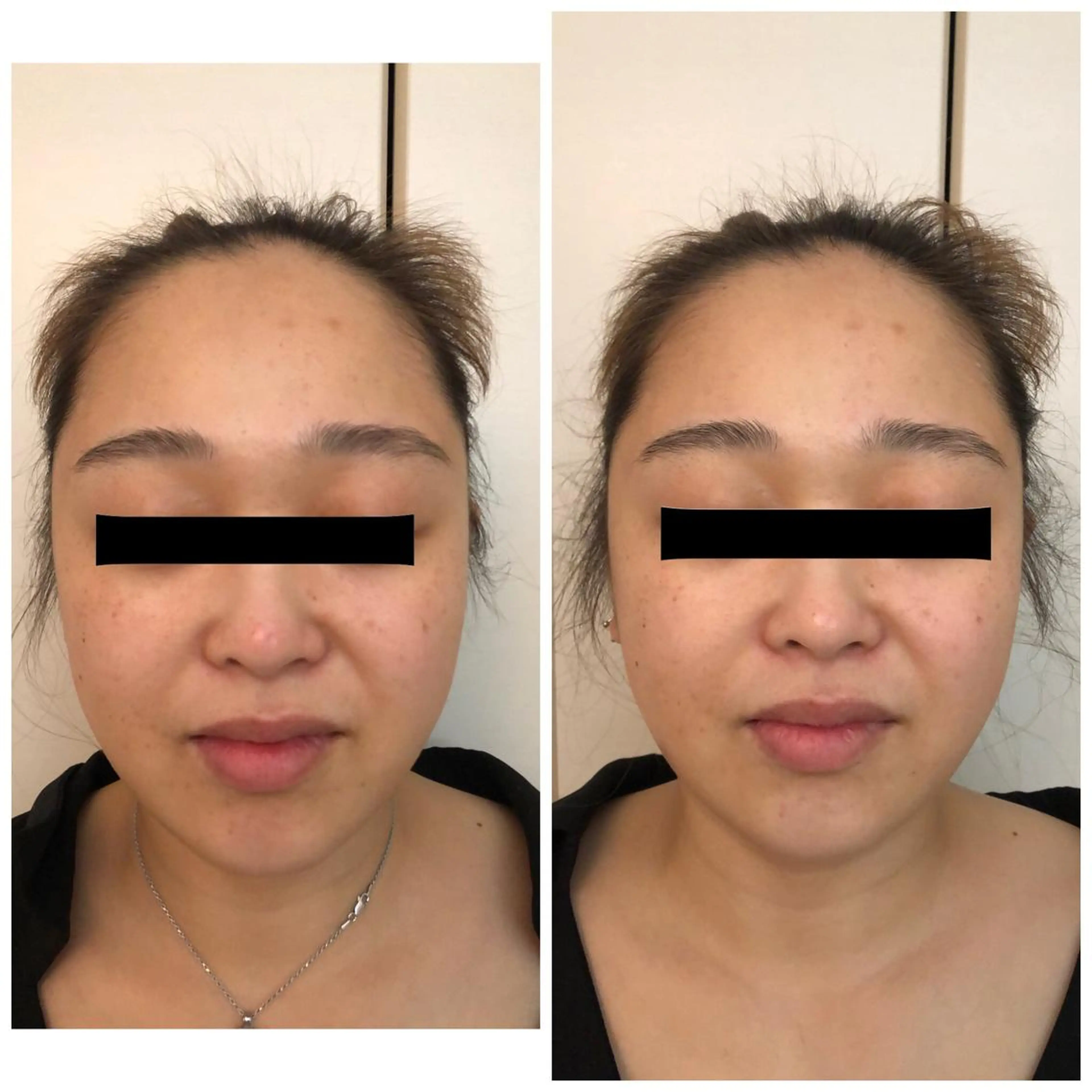 エステ リラク おうちサロン B-ROOMのエステ・リラクイメージ