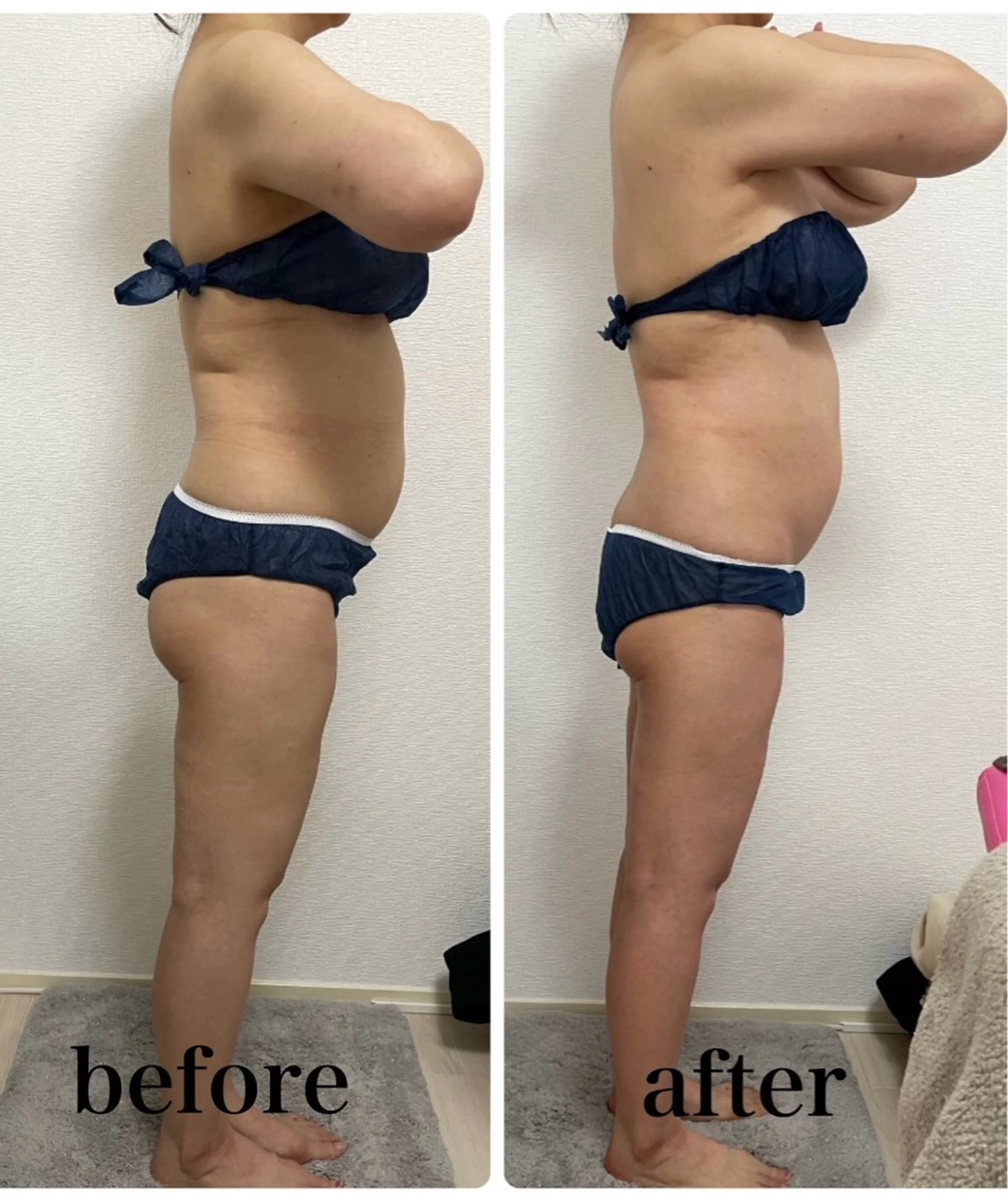 エステ Esthe salon Blanche(エステサロンブランシュ)所属・小顔リフトアップ 美肌改善専門店のエステ・リラクイメージ