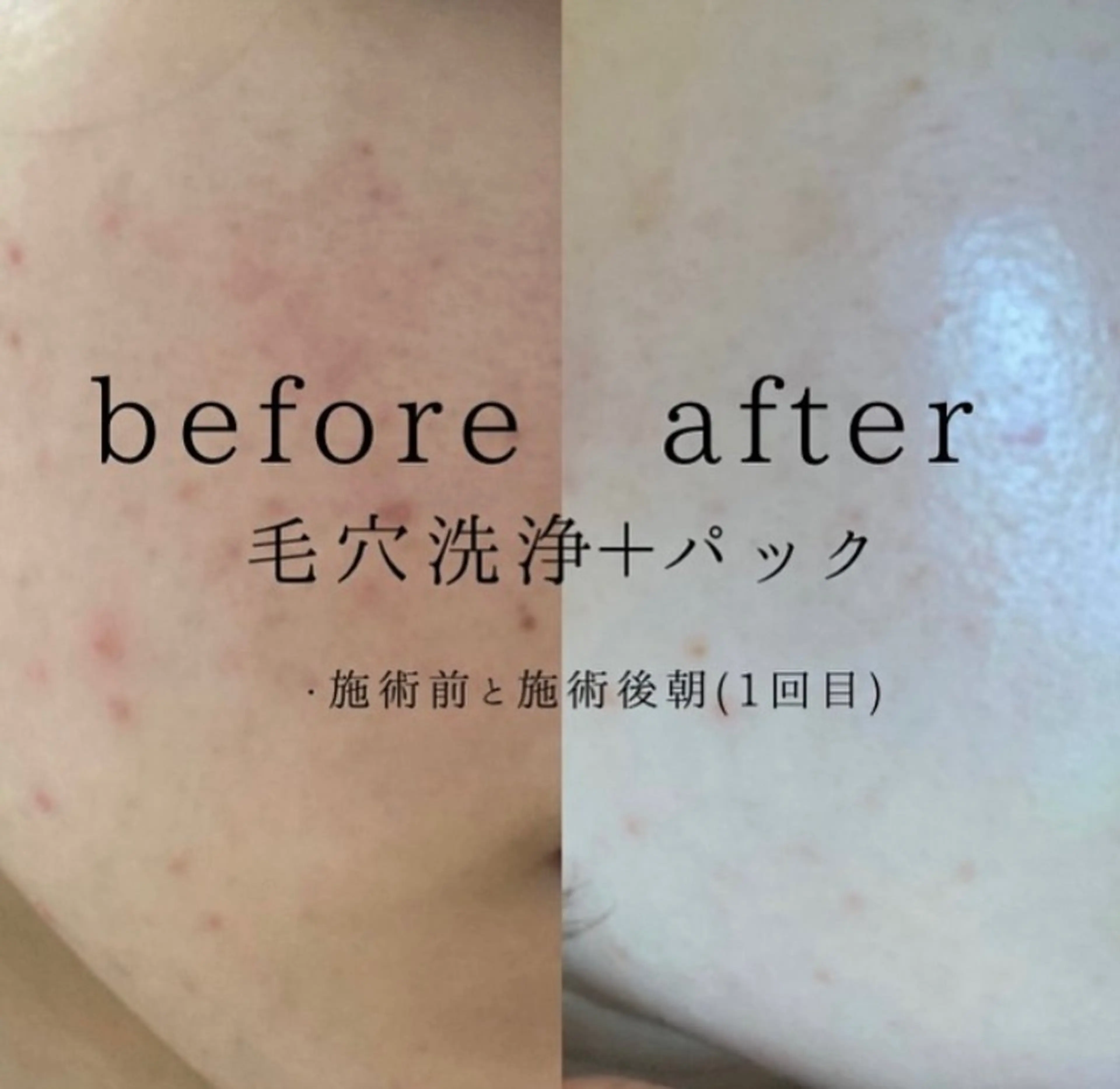 肌質改善サロン🌻 Nico laughのエステ・リラクイメージ