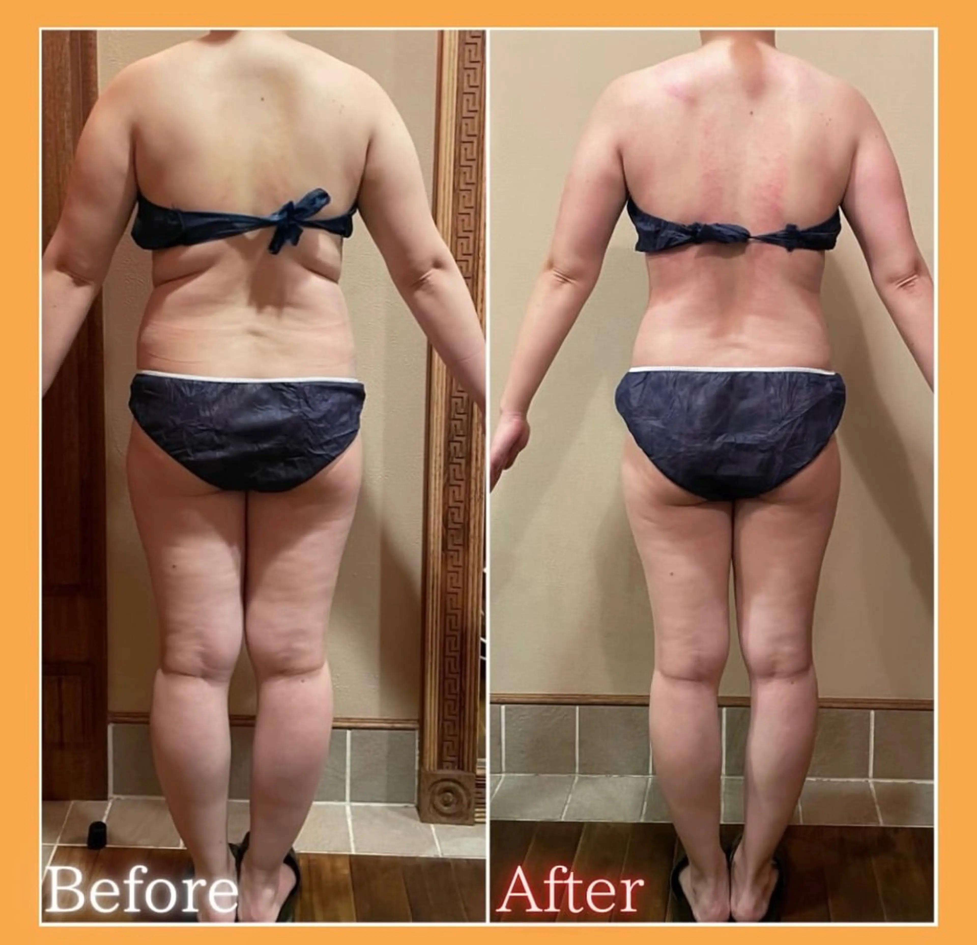 エステ 痩身＆美肌サロン 三浦のその他イメージ