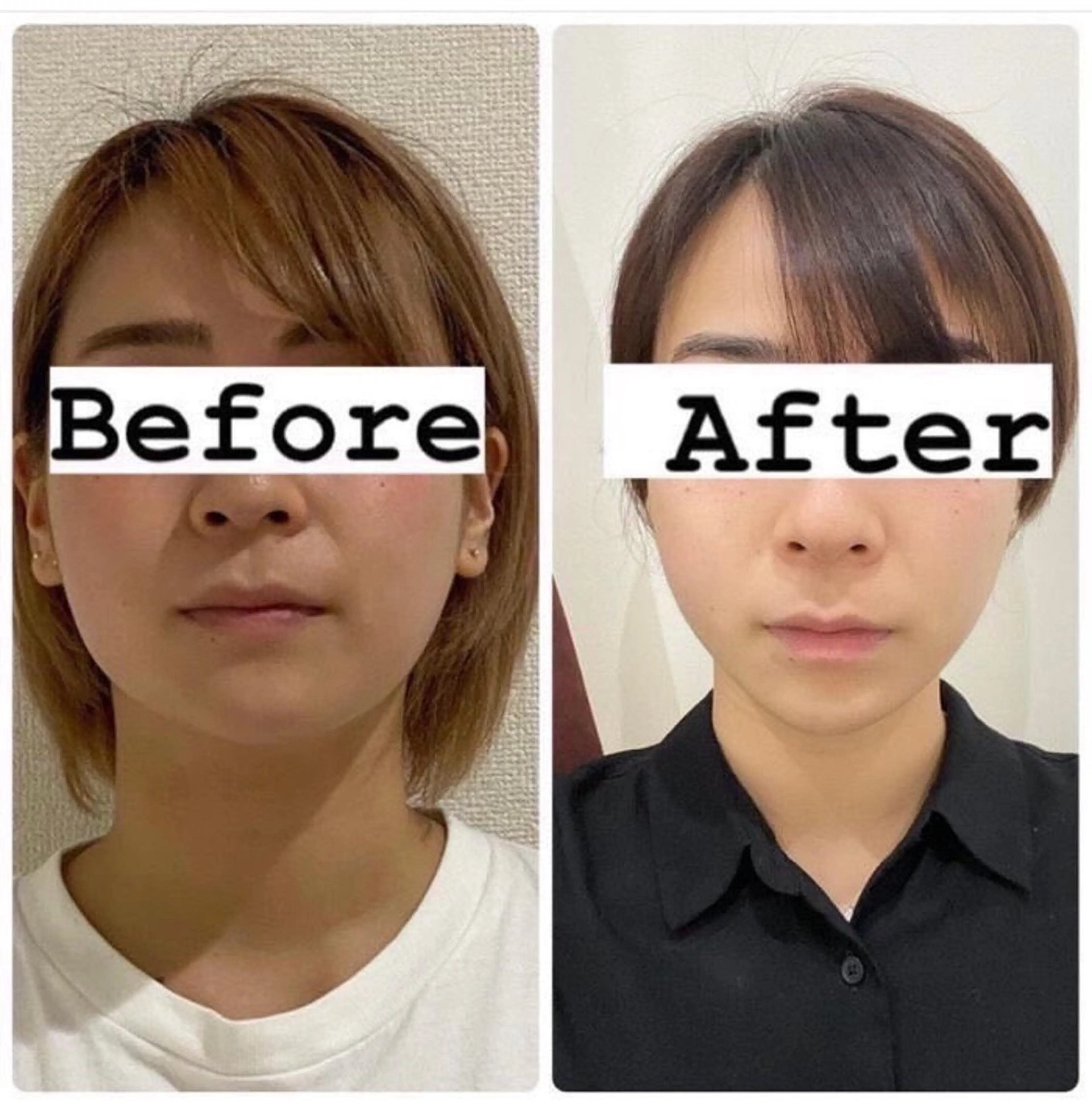 インモードの写真