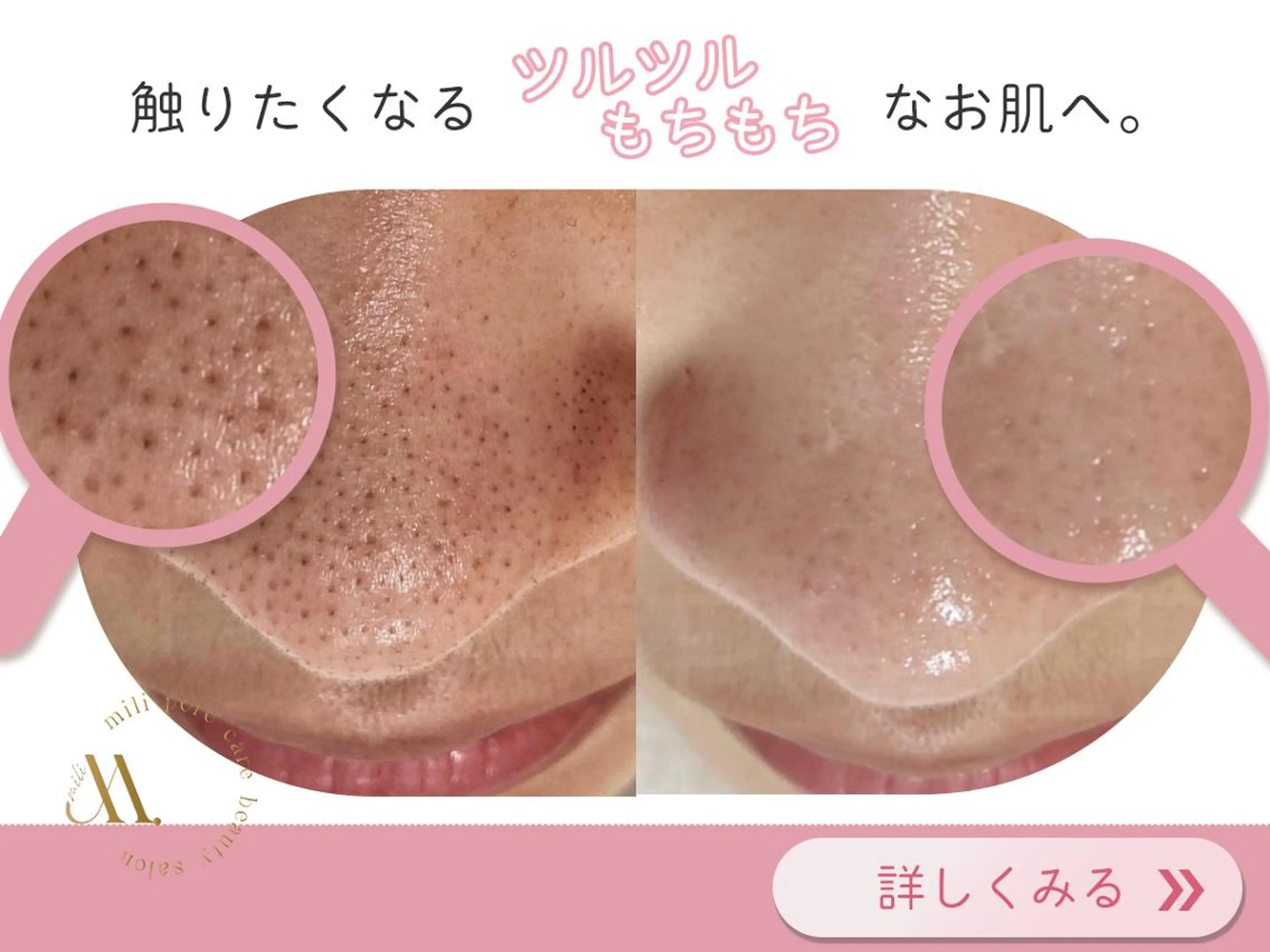 エステ 毛穴ケア専門サロン miliのエステ・リラクイメージ