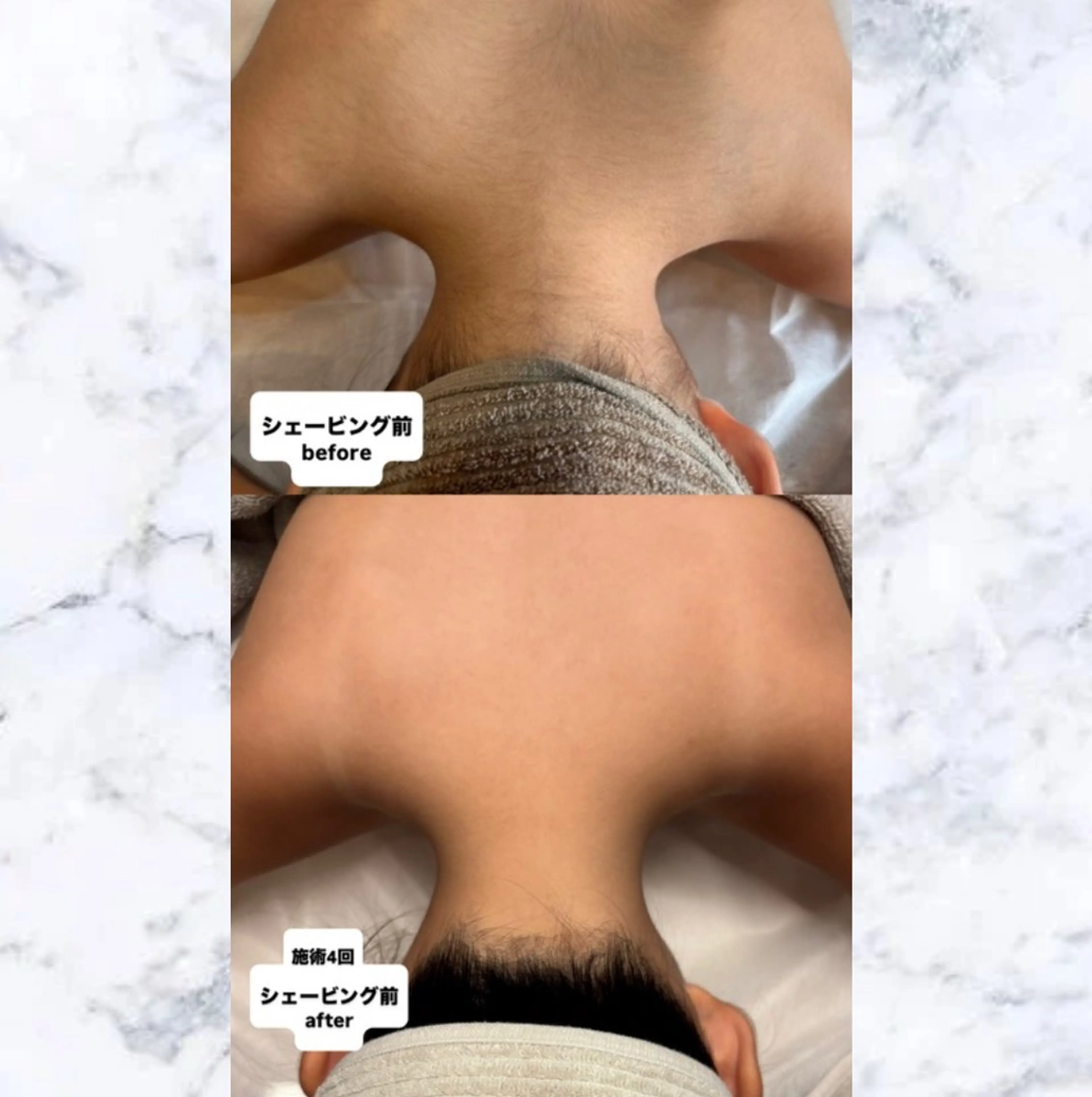 子供脱毛専門サロンReme【リミー】所属・添田 彩葉のエステ・リラクイメージ