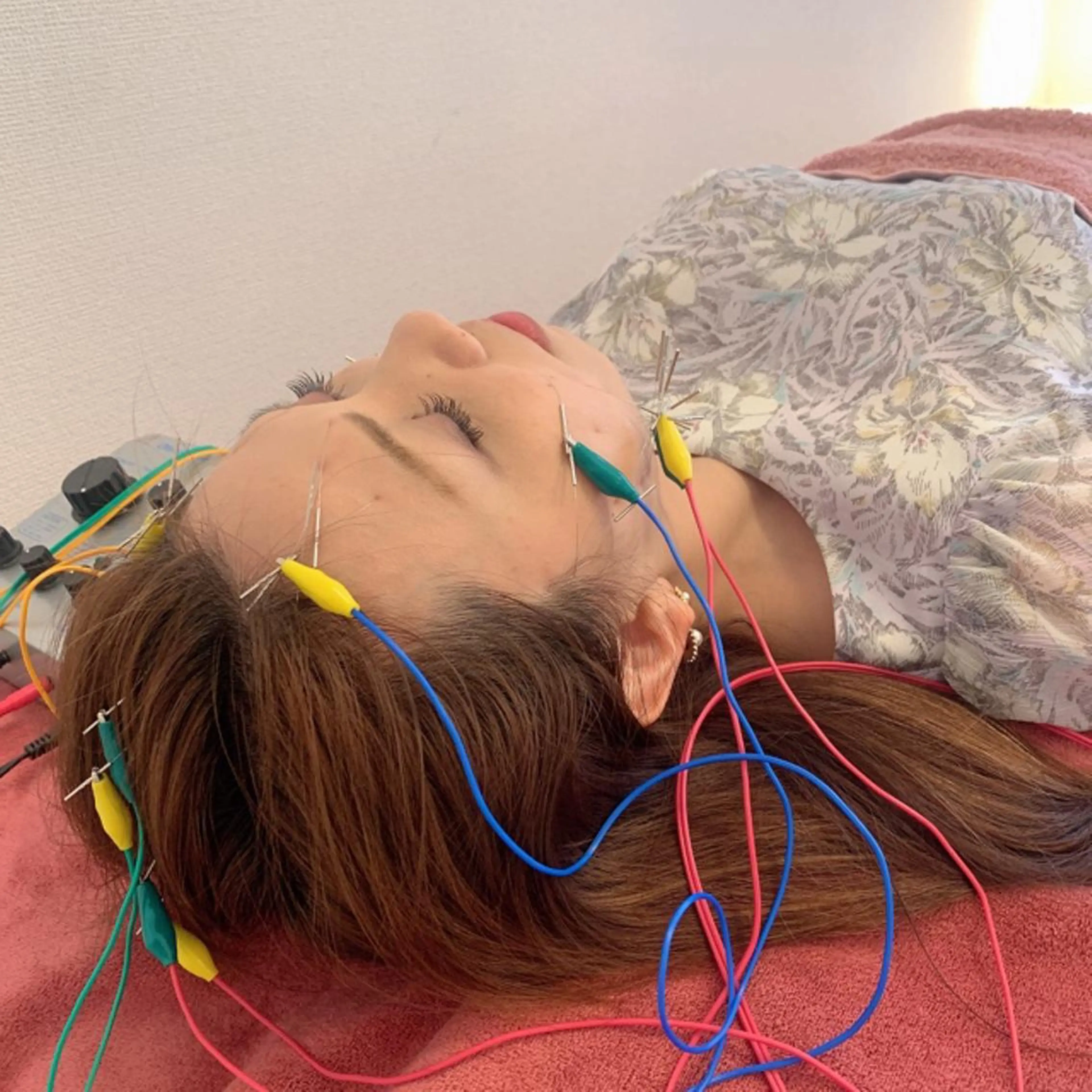 新宿hari-me所属・美容鍼hari-me 新宿のエステ・リラクイメージ