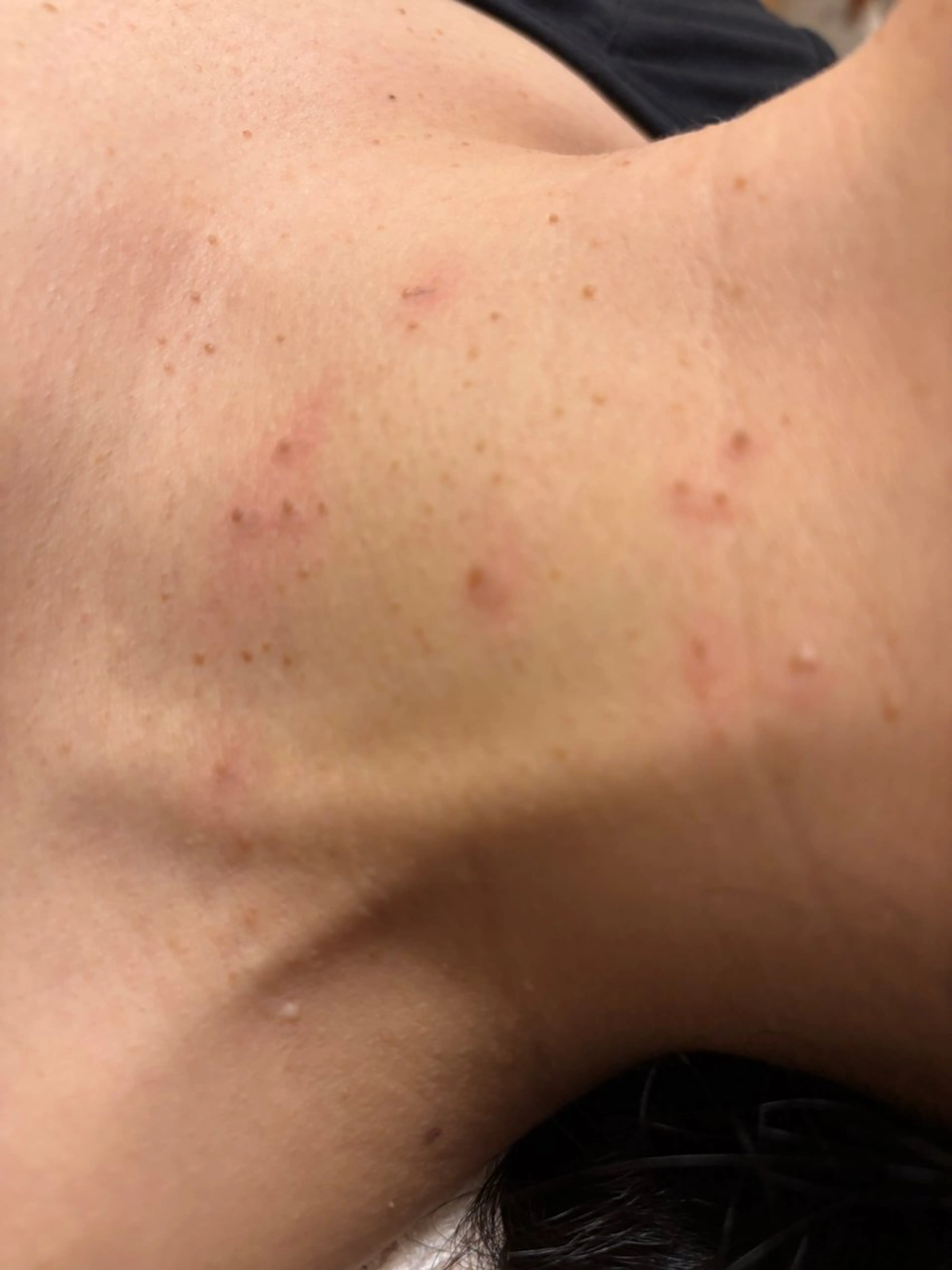 大阪大東市 / 体質・肌質改善サロン アンシャンテ所属・体質・肌質改善サロン アンシャンテのエステ・リラクイメージ