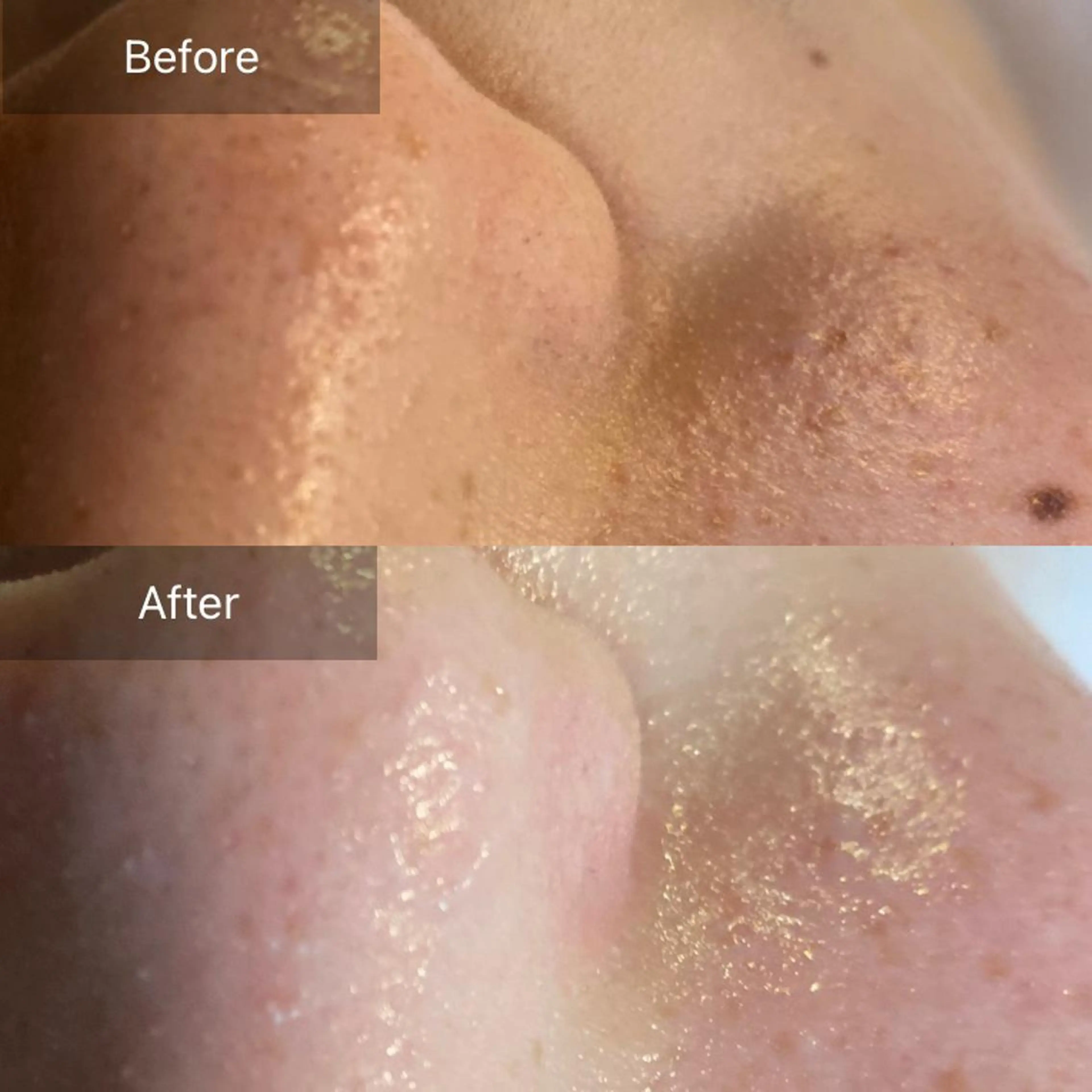 Mandarin Orange所属・毛穴から始める肌メン テマンダリンオレンジのエステ・リラクイメージ