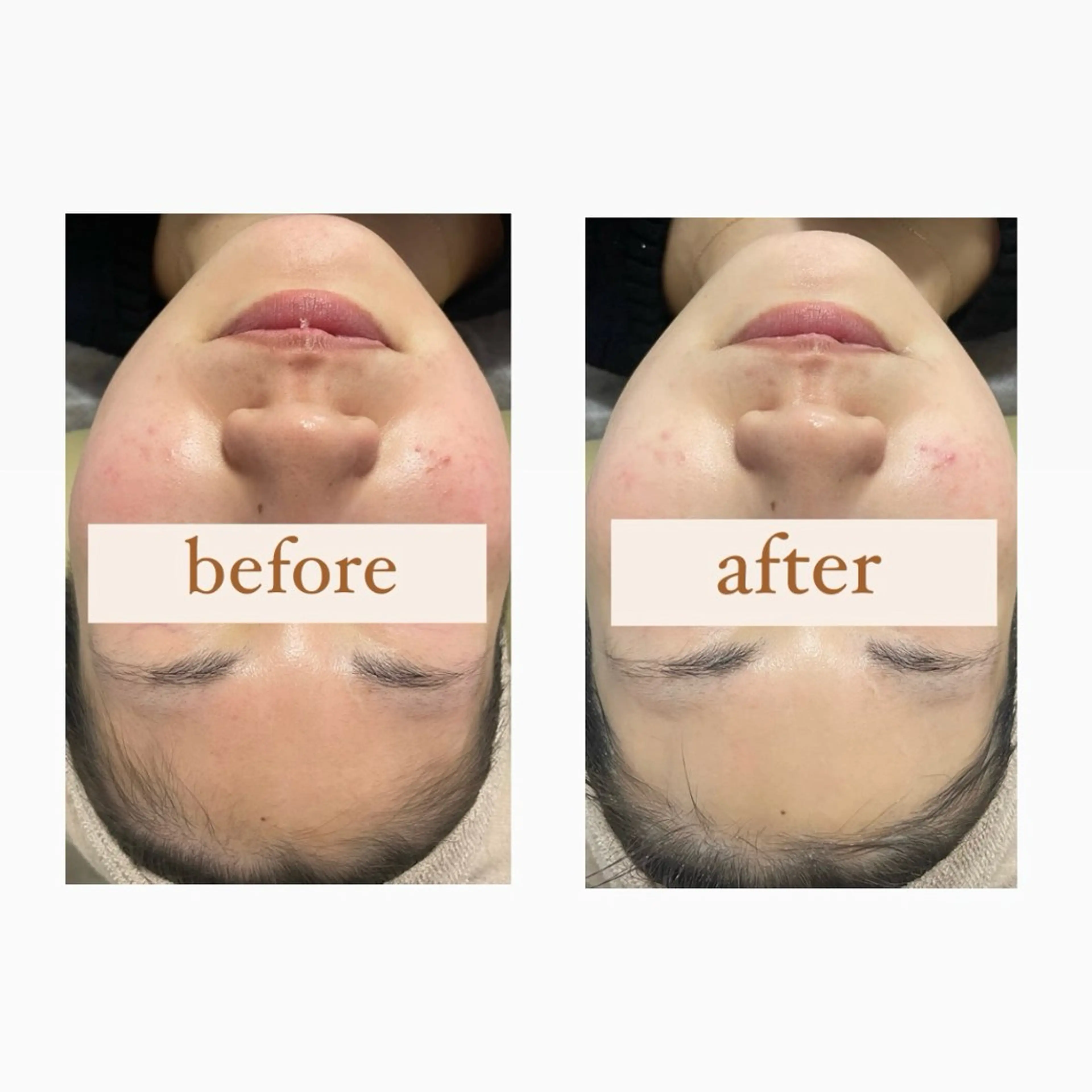 エステ crescent所属・【韓国肌管理・脱毛】 クレセントのその他イメージ