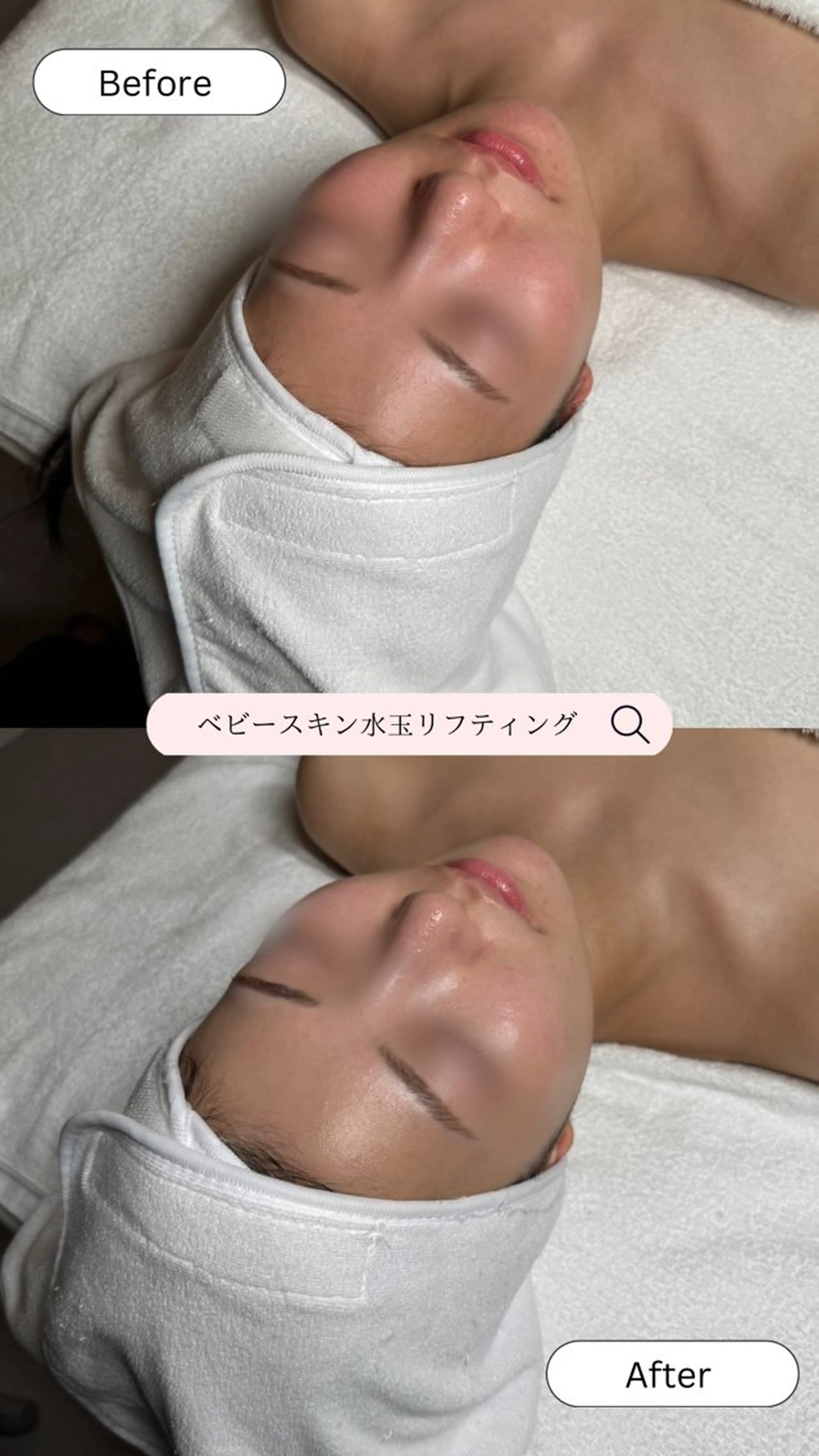 韓国肌管理🫧LDM 🫧Junnaのエステ・リラクイメージ