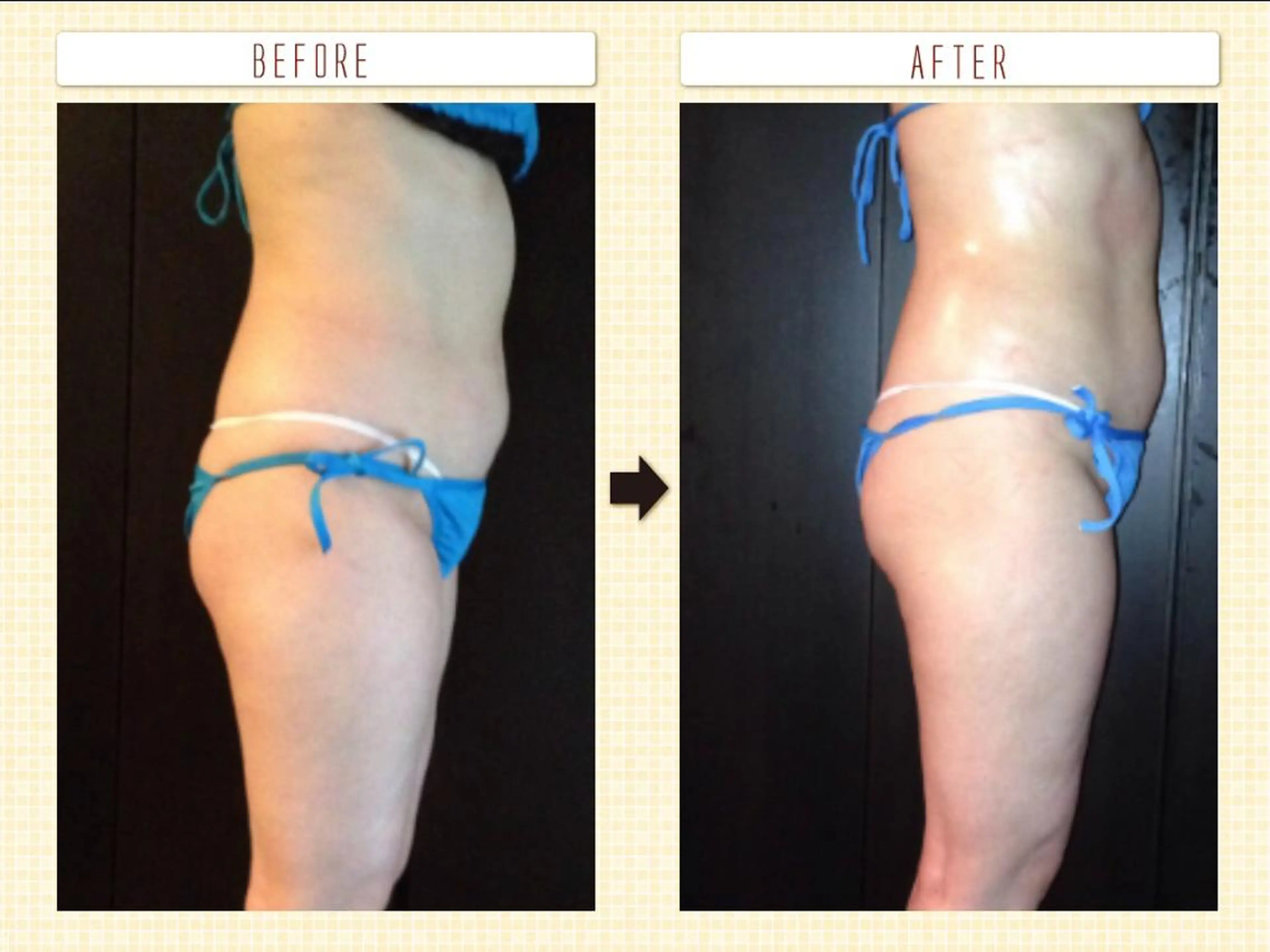 Morisugi Natsumiのエステ・リラクイメージ