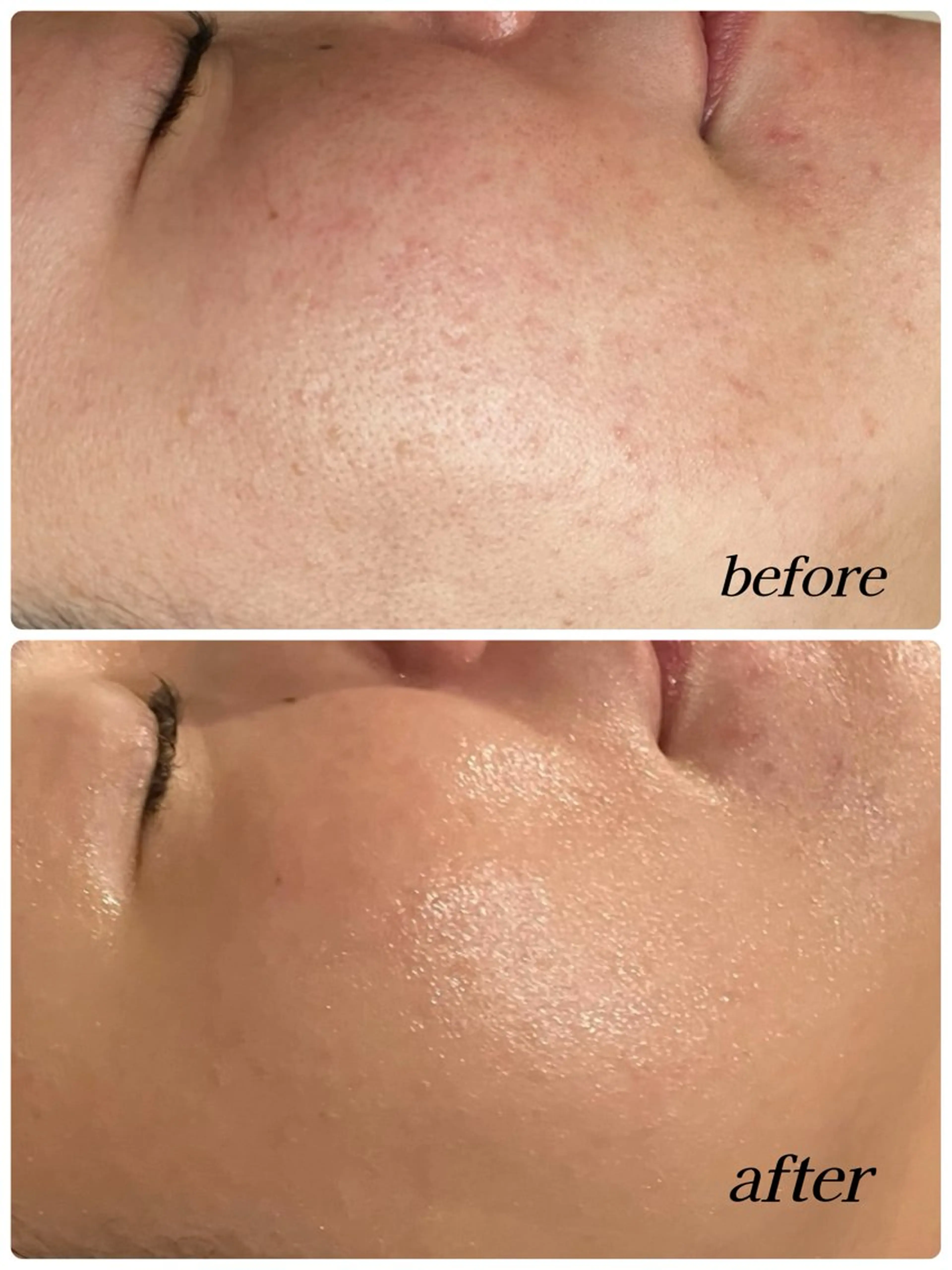 NAVI 韓国肌管理所属・NAVI韓国肌管理《 毛穴/艶肌/小顔》のエステ・リラクイメージ