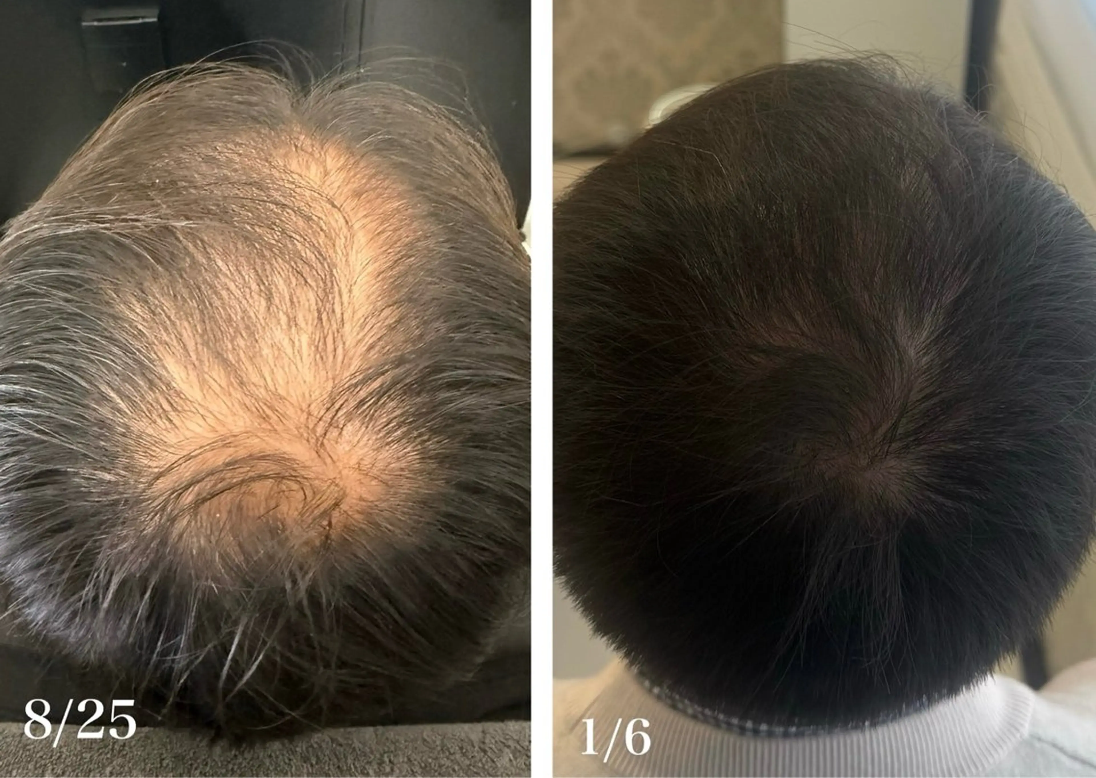 メンズ キッズ ヘッドスパ 韓国最先端技術サロン Luangeのヘアスタイル