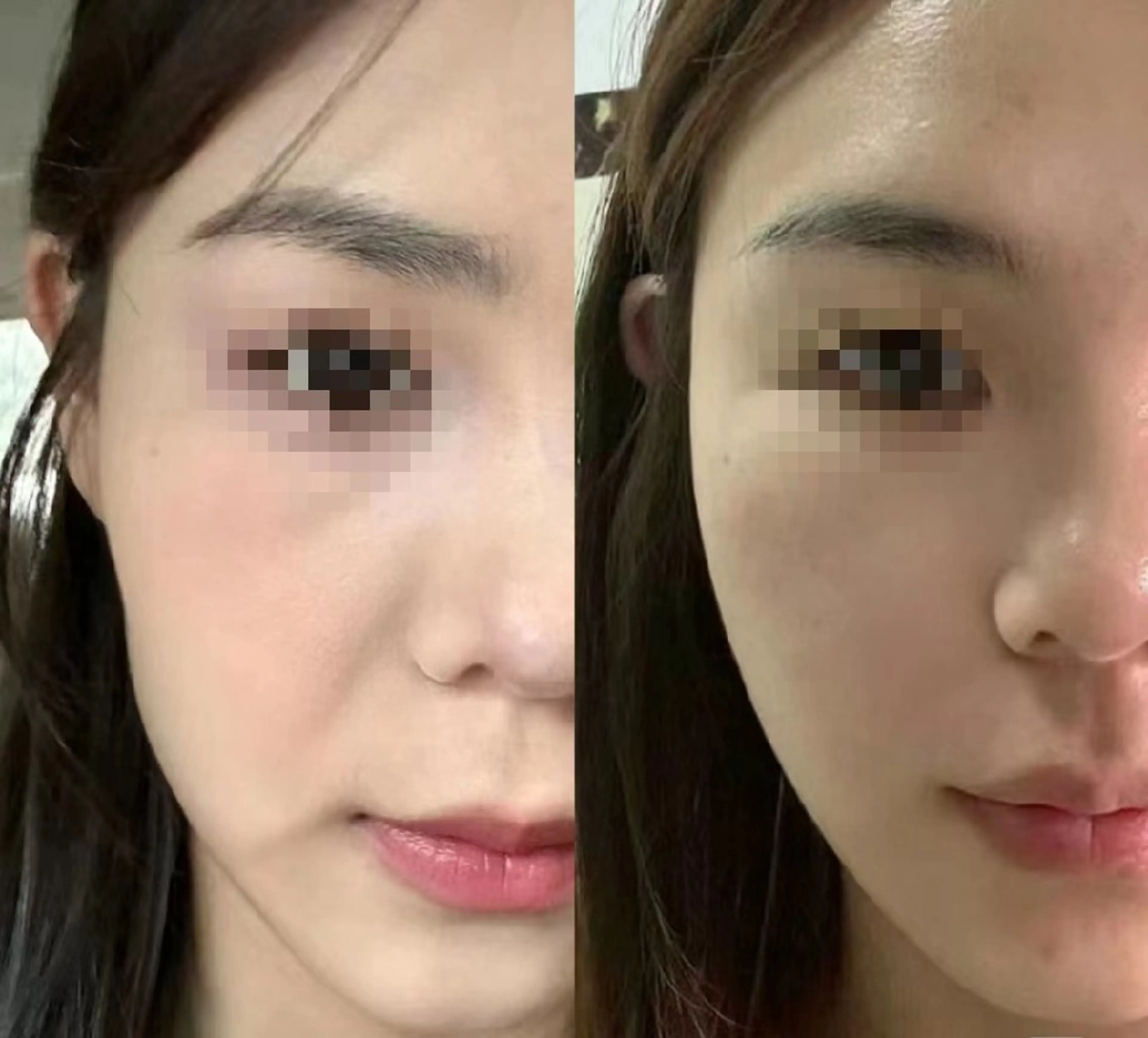 マツエク・マツパ 結婚式・ブライダル aliaハイフ&水光ジェットサロン所属・aliaハーブ水光店 エステティシャン募集のエステ・リラクイメージ