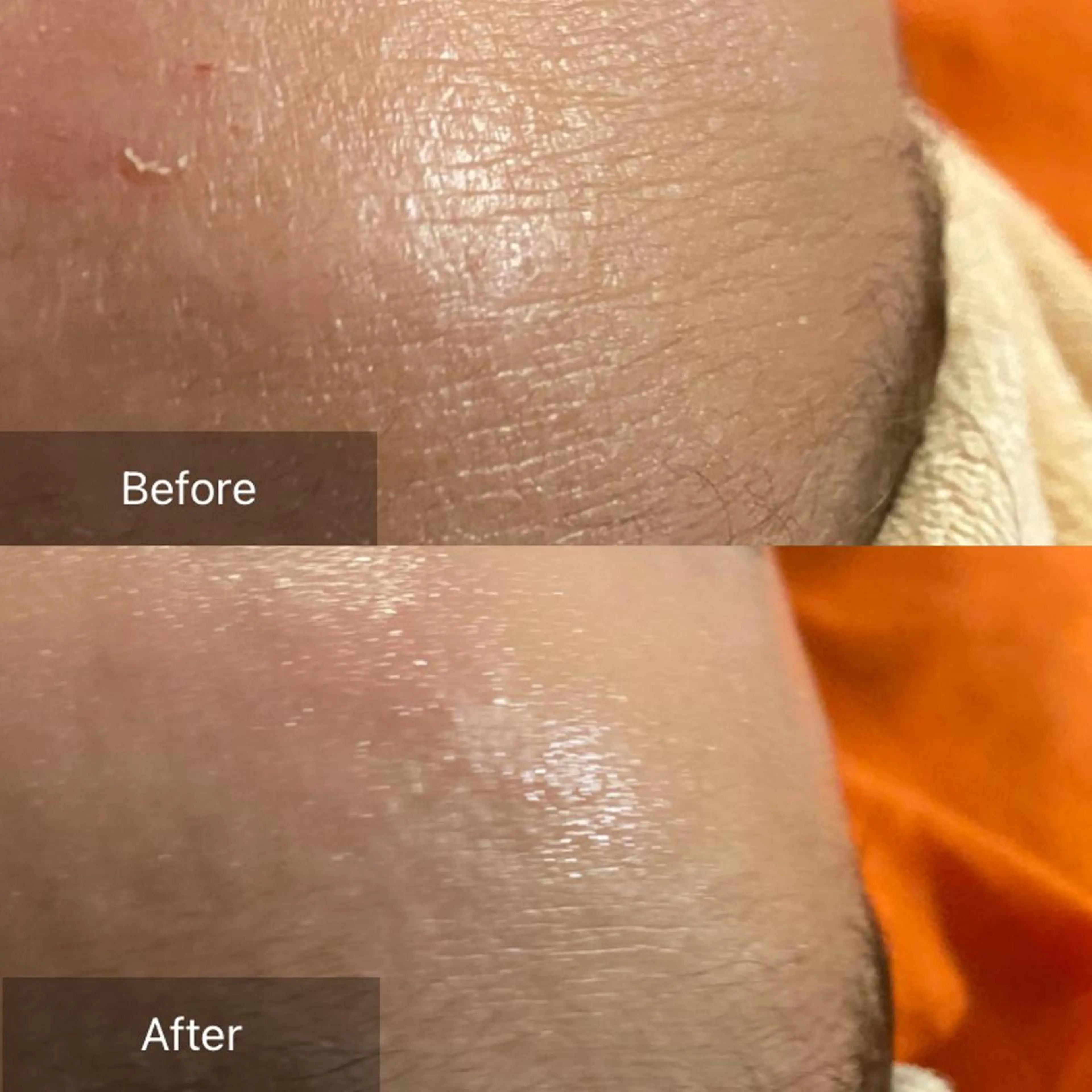 Mandarin Orange所属・毛穴から始める肌メン テマンダリンオレンジのエステ・リラクイメージ