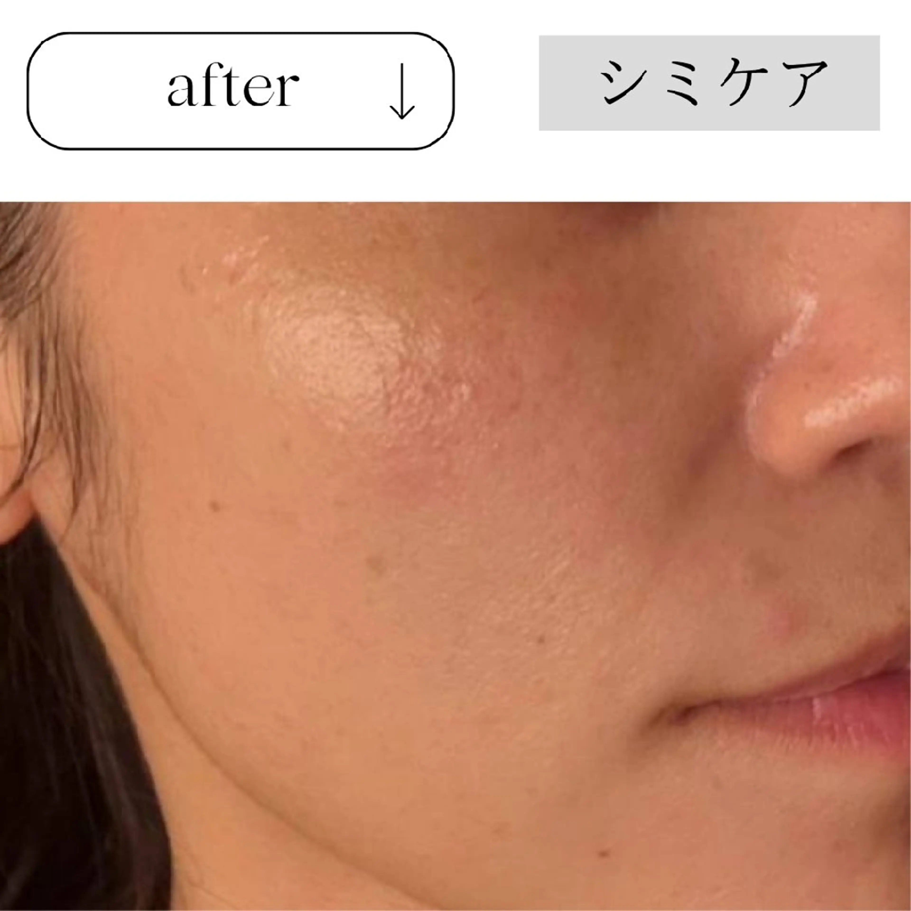 エステ リラク ICHOOSE/ 代々木上原のエステ・リラクイメージ