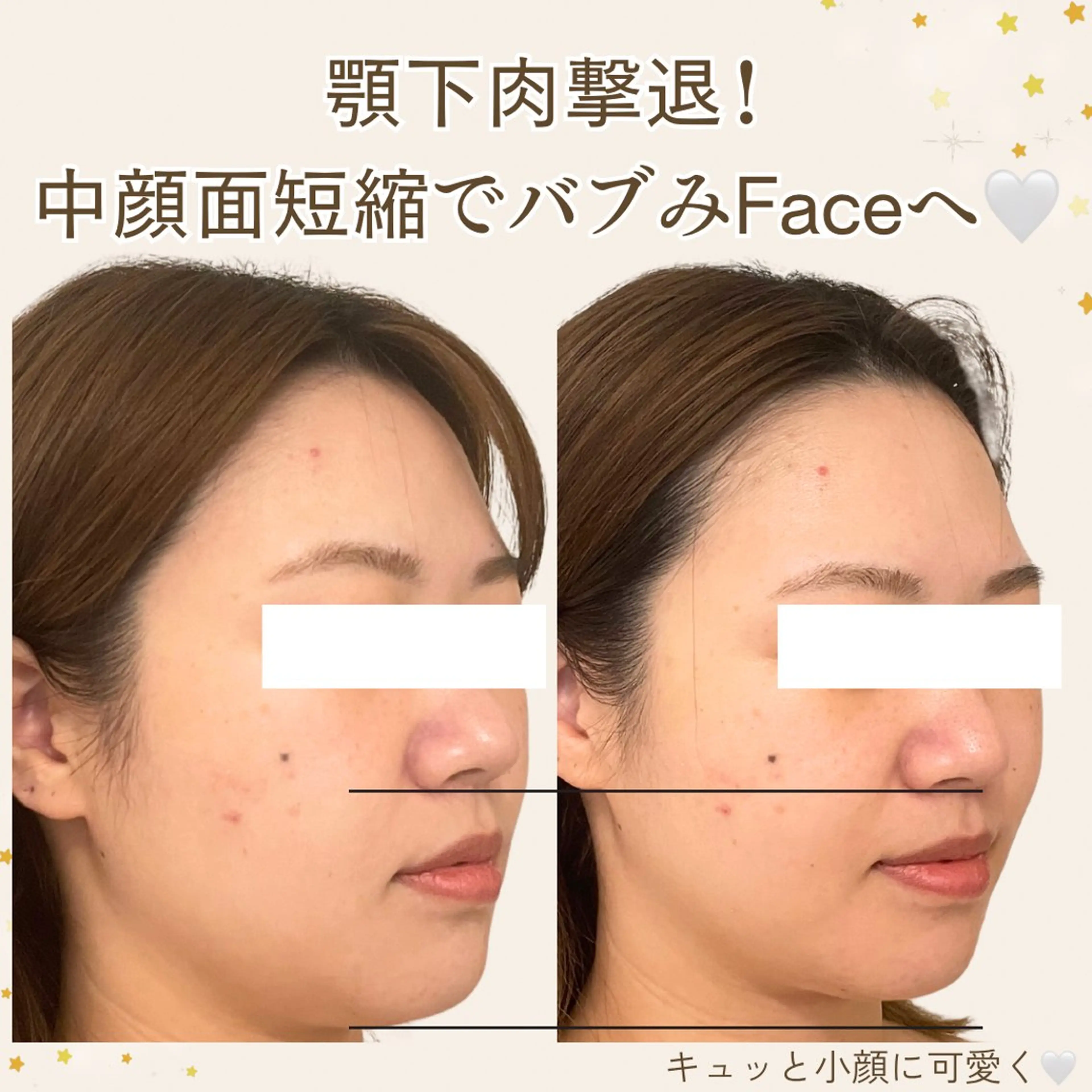 エステ 小顔/たるみ/黒ずみ除去専門サロン/SONA 大和西大寺店所属・【小顔専門看護師 サロンSONA】のエステ・リラクイメージ