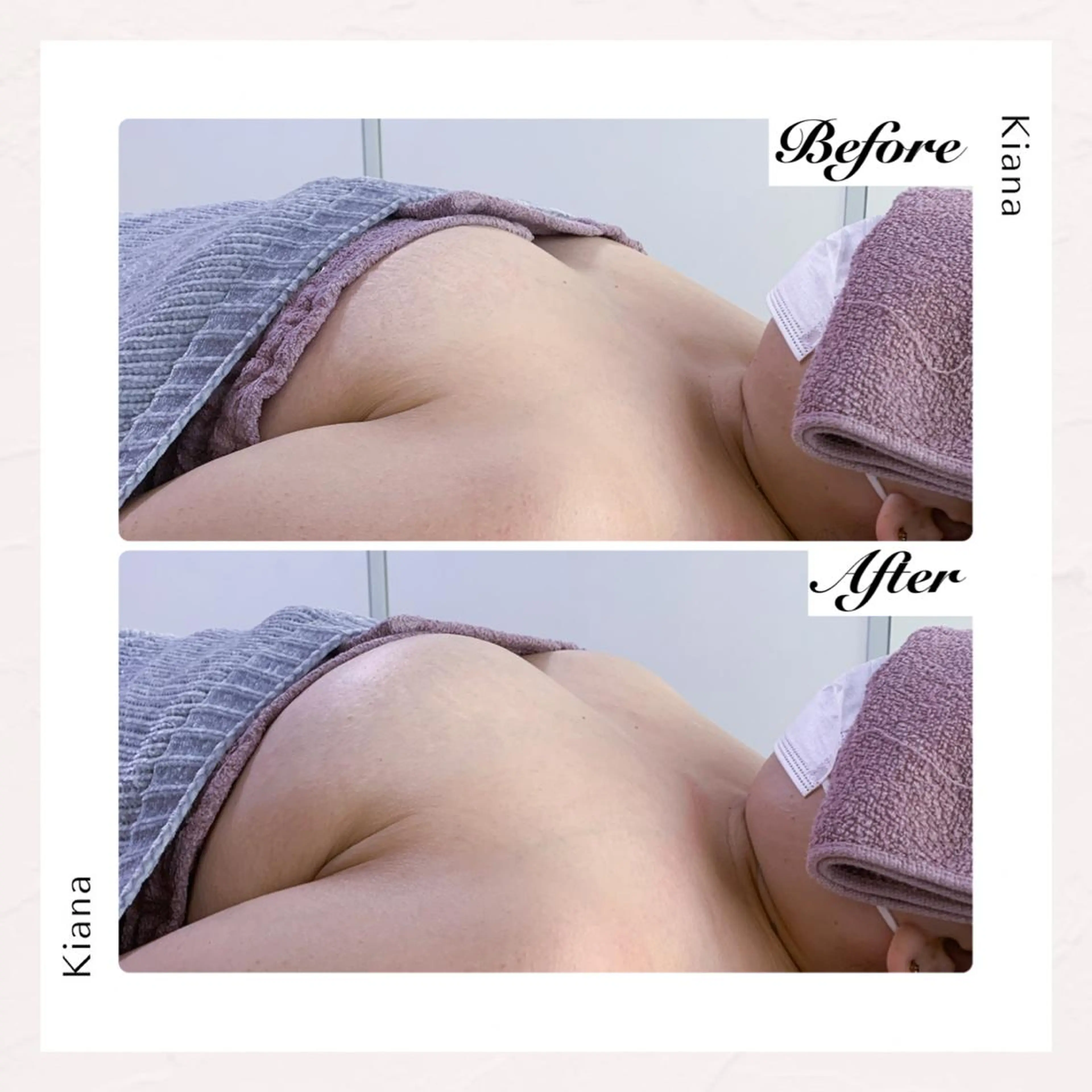 バスト専門Kiana 風のエステ・リラクイメージ