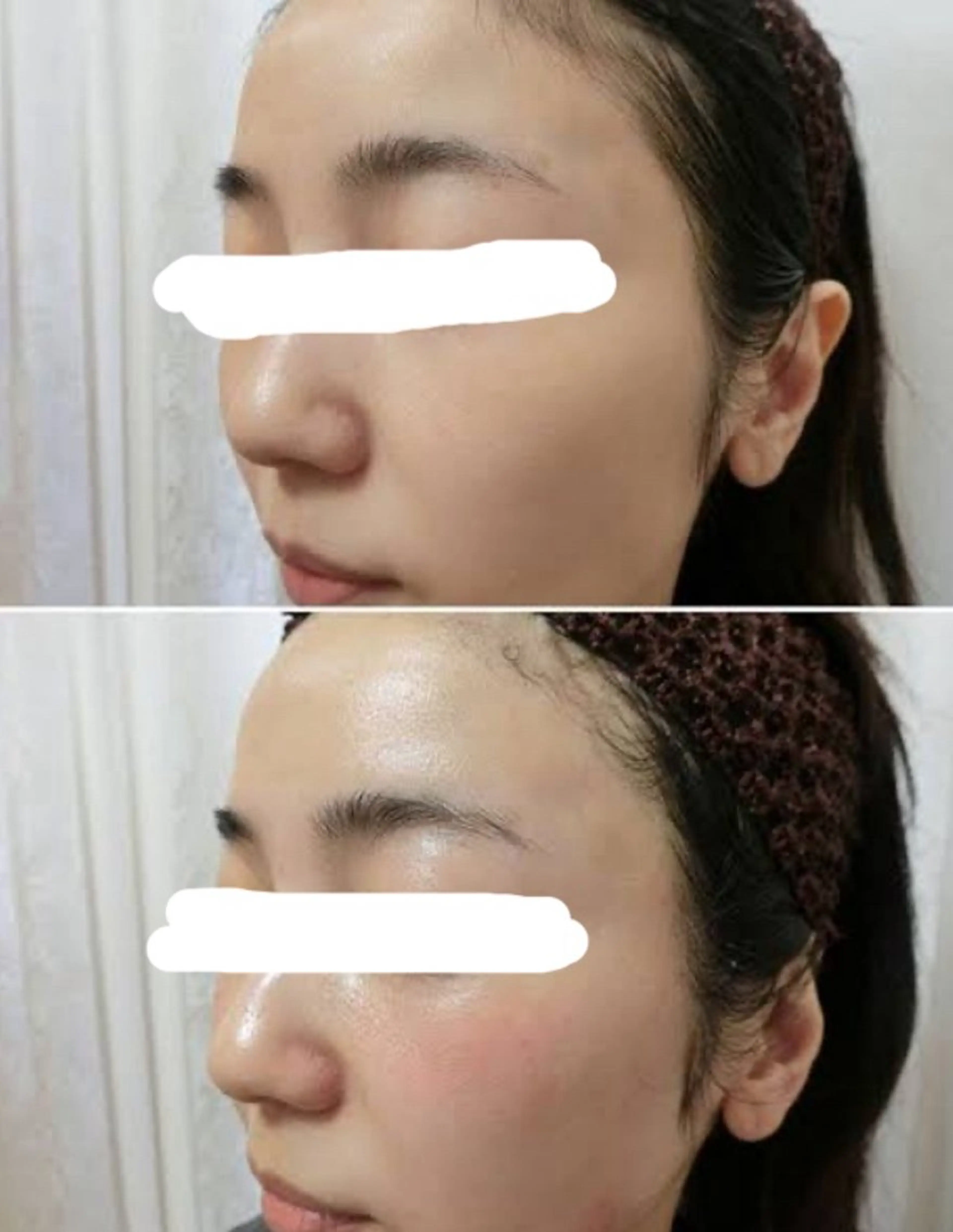 小顔マッサージ超音波の写真