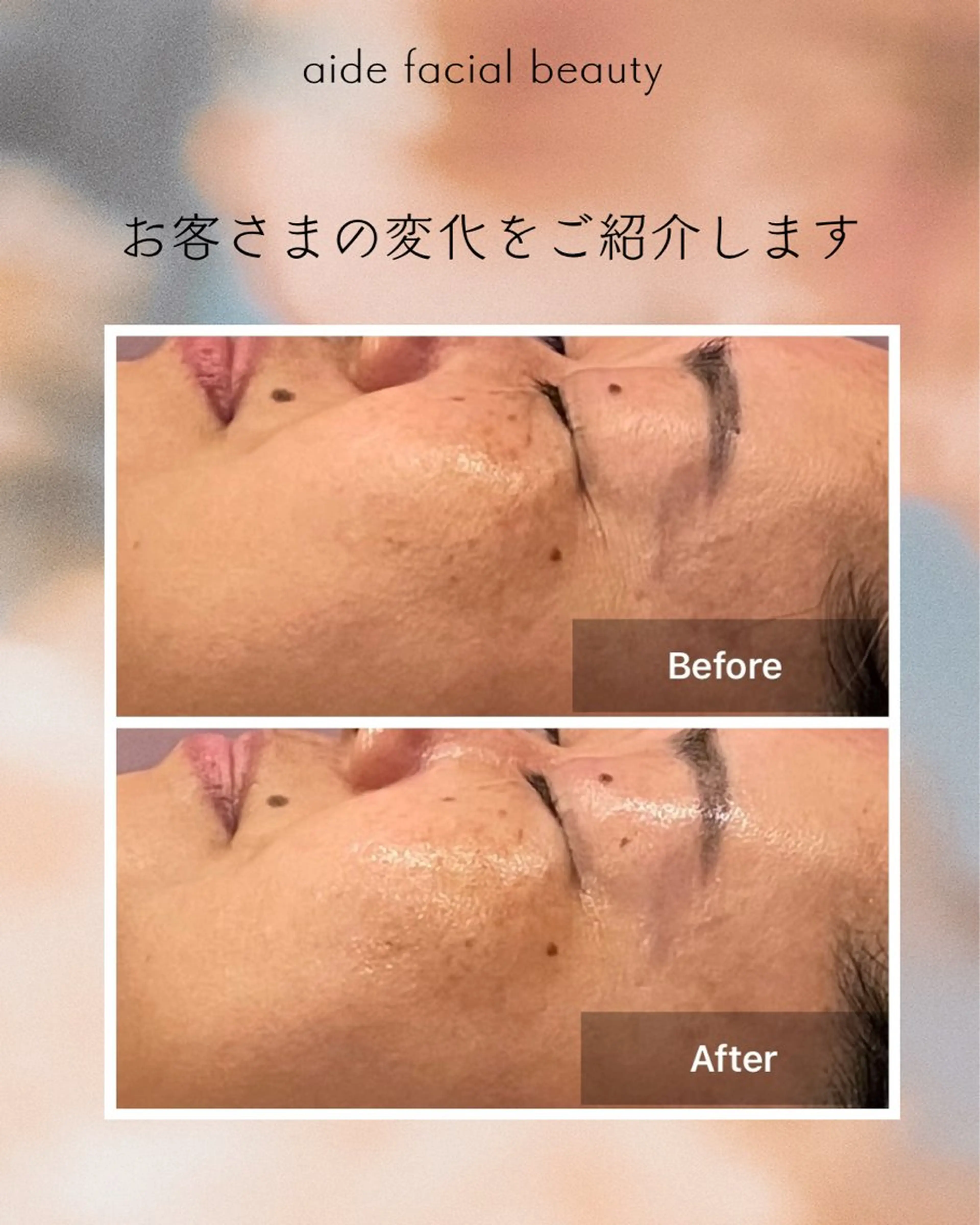エステ aide facial beauty所属・aide 女性の為の美と健康のその他イメージ