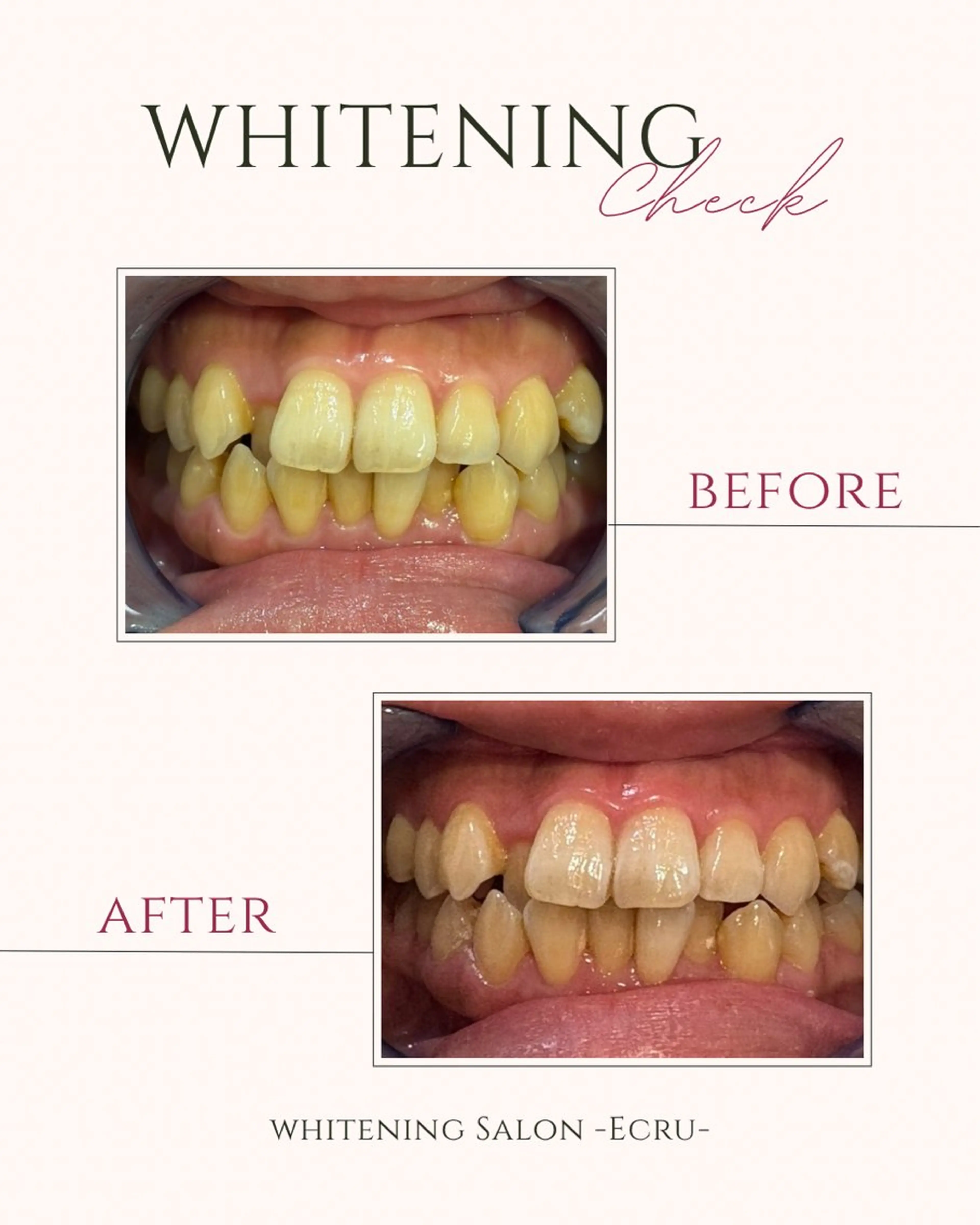 その他 ホワイトニングサロン Ecru所属・ホワイトニングサロン Ecru エクリュのその他イメージ