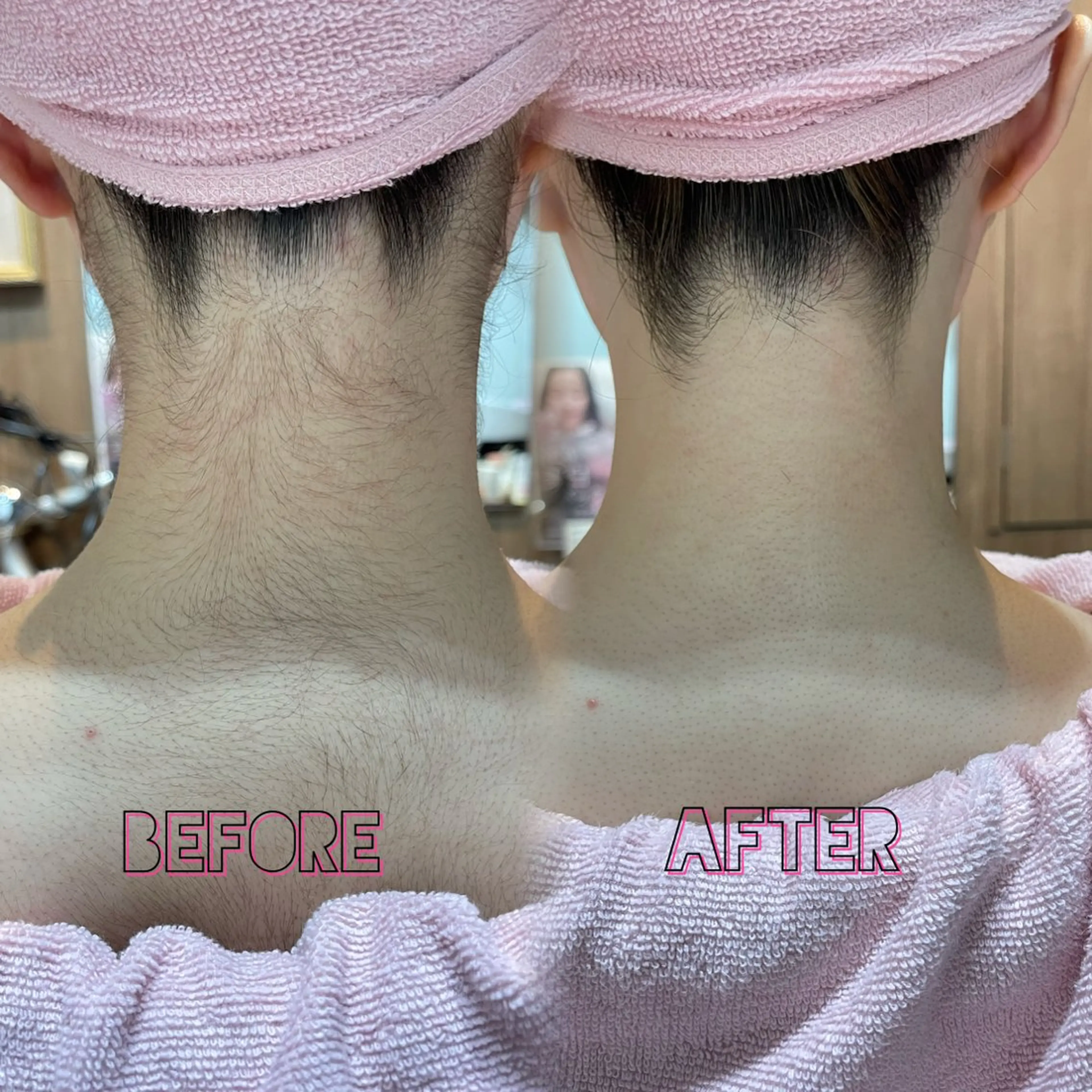 その他 🫧美しい素肌へ🫧 今成柚乃のその他イメージ