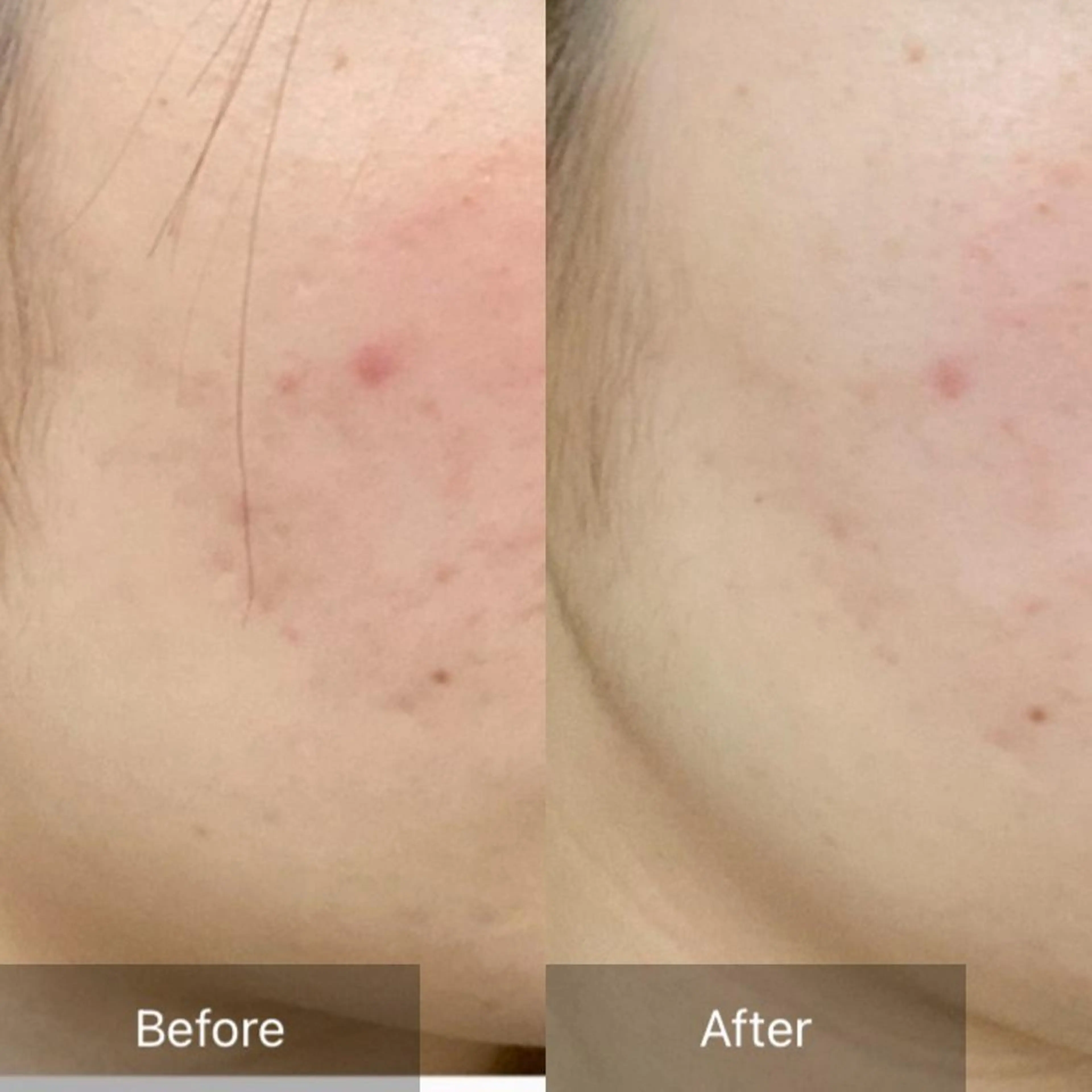 脱毛 産毛専門店 Bittoのエステ・リラクイメージ