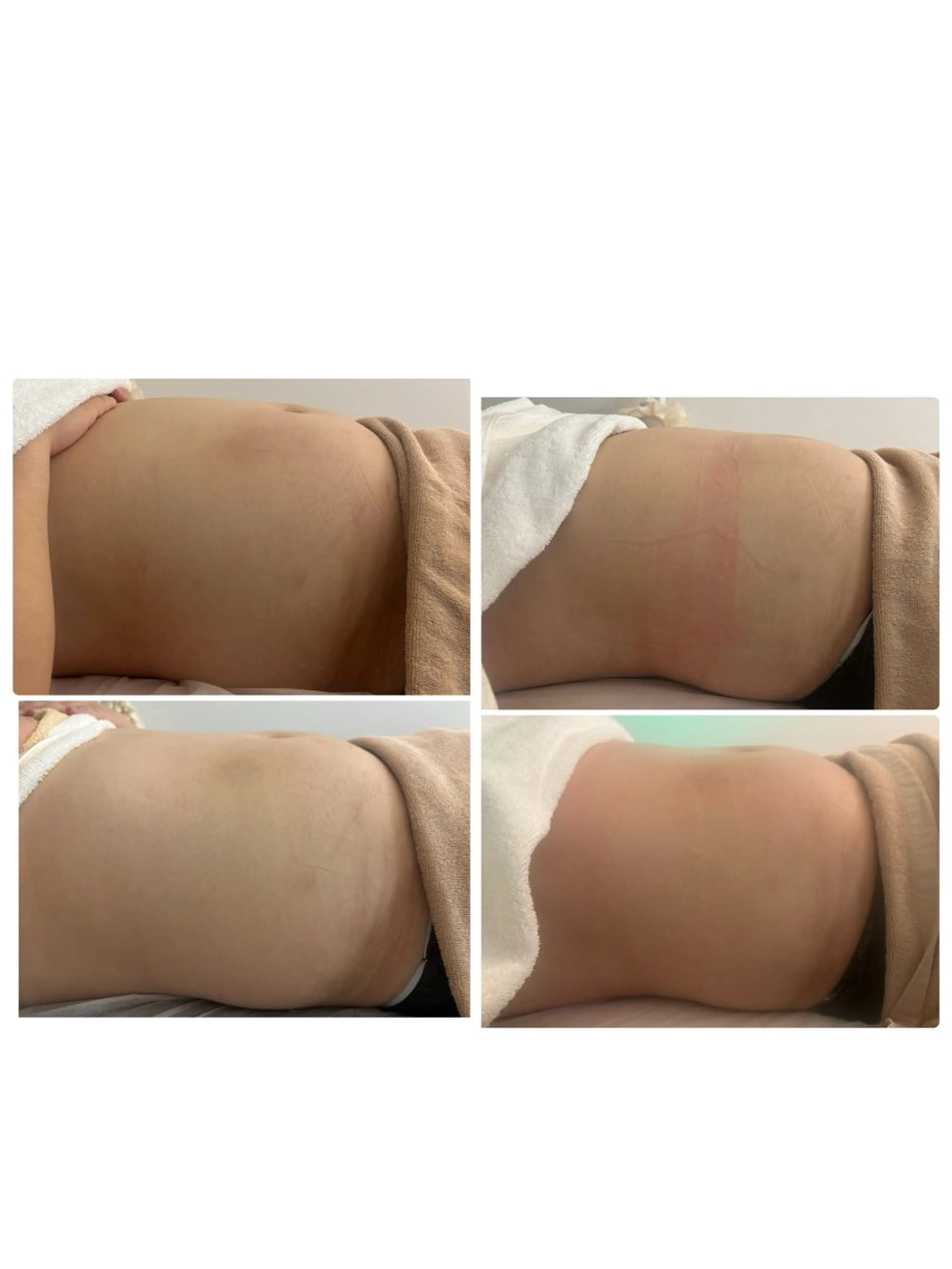 solo tu  salon MANA所属・美肌＆痩身＆脱毛 MANAのエステ・リラクイメージ