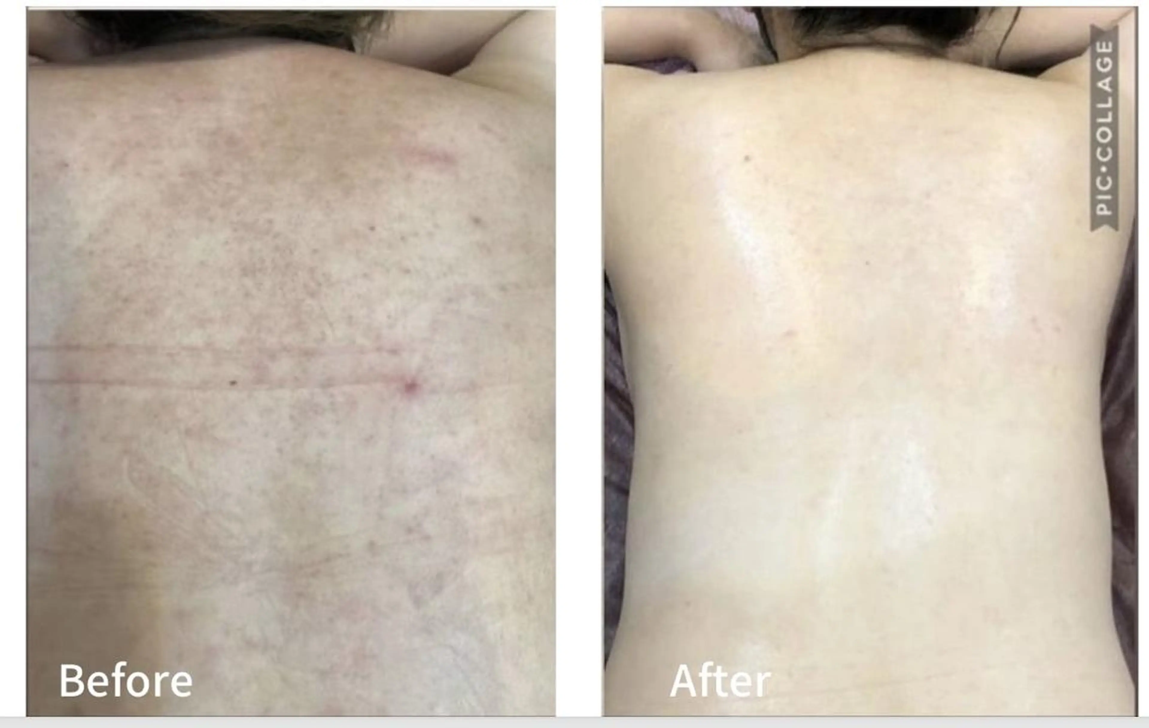 アンジェリック ビーナス　Rinonのエステ・リラクイメージ