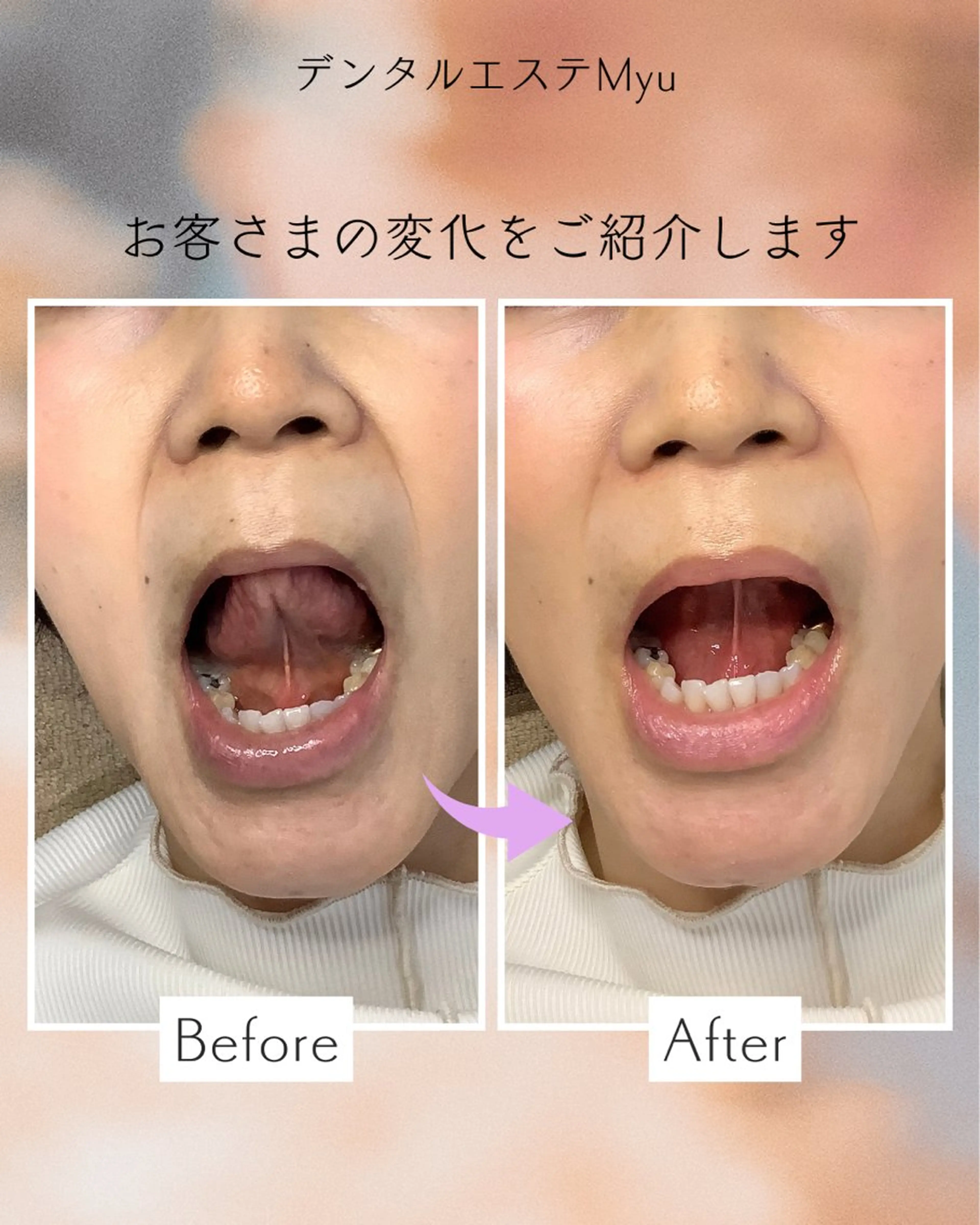 Myu所属・Suzuki Yumiのエステ・リラクイメージ