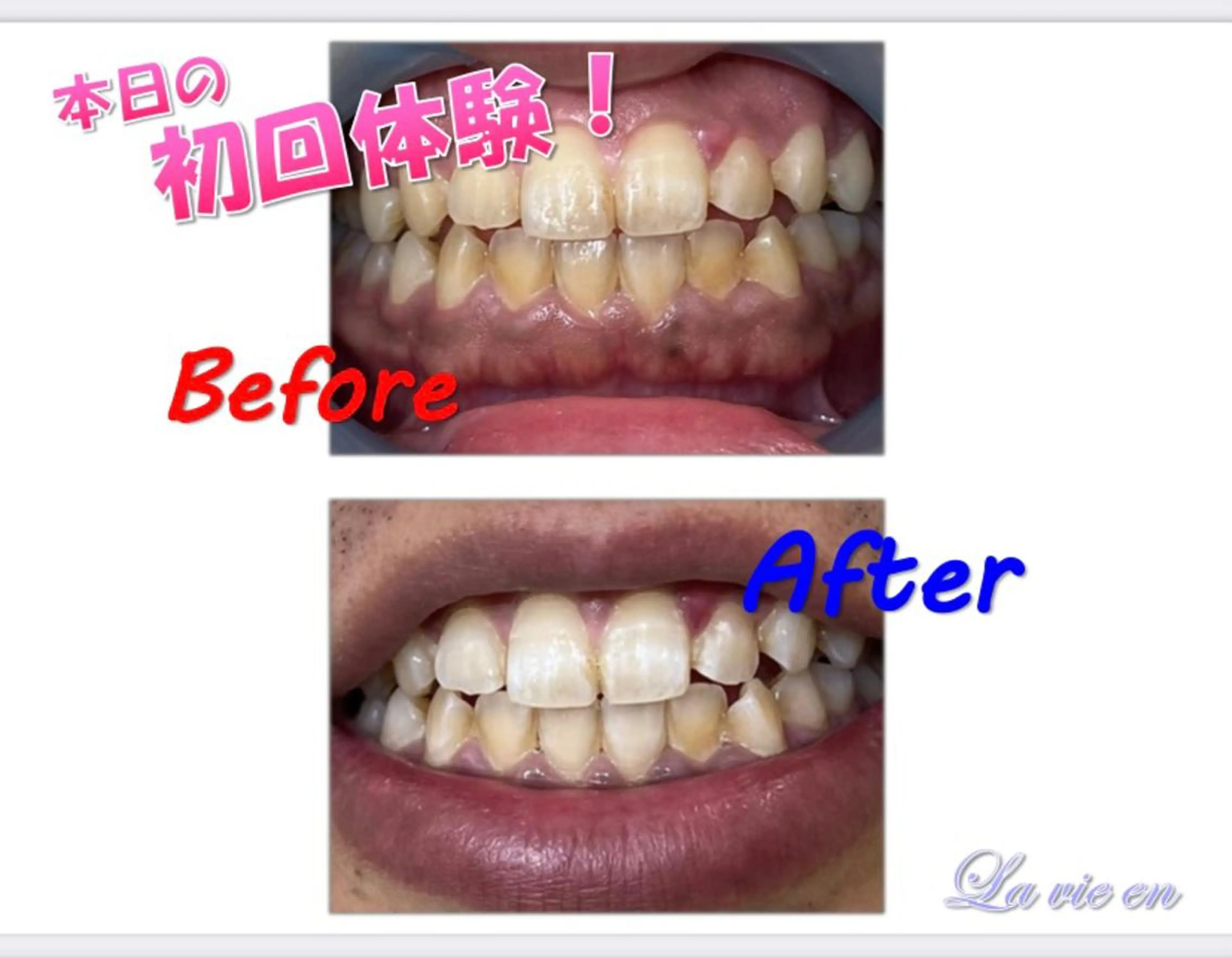 その他 セルフホワイトニングサロン　ラヴィアン所属・ホワイトニングサロン La vie enのその他イメージ