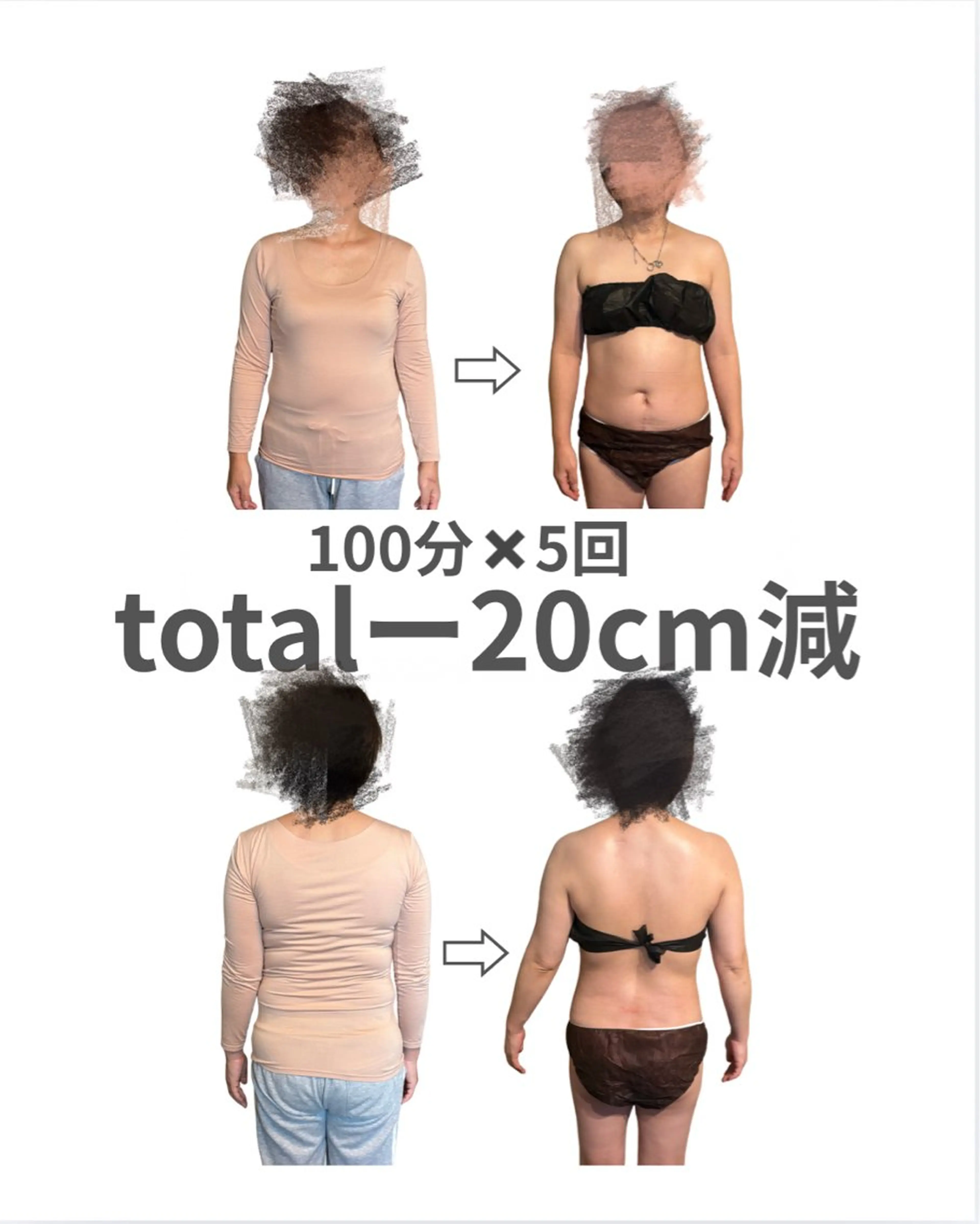 1/31まで💍ドレス映え姿勢×くびれ実感ブライダルケアの写真