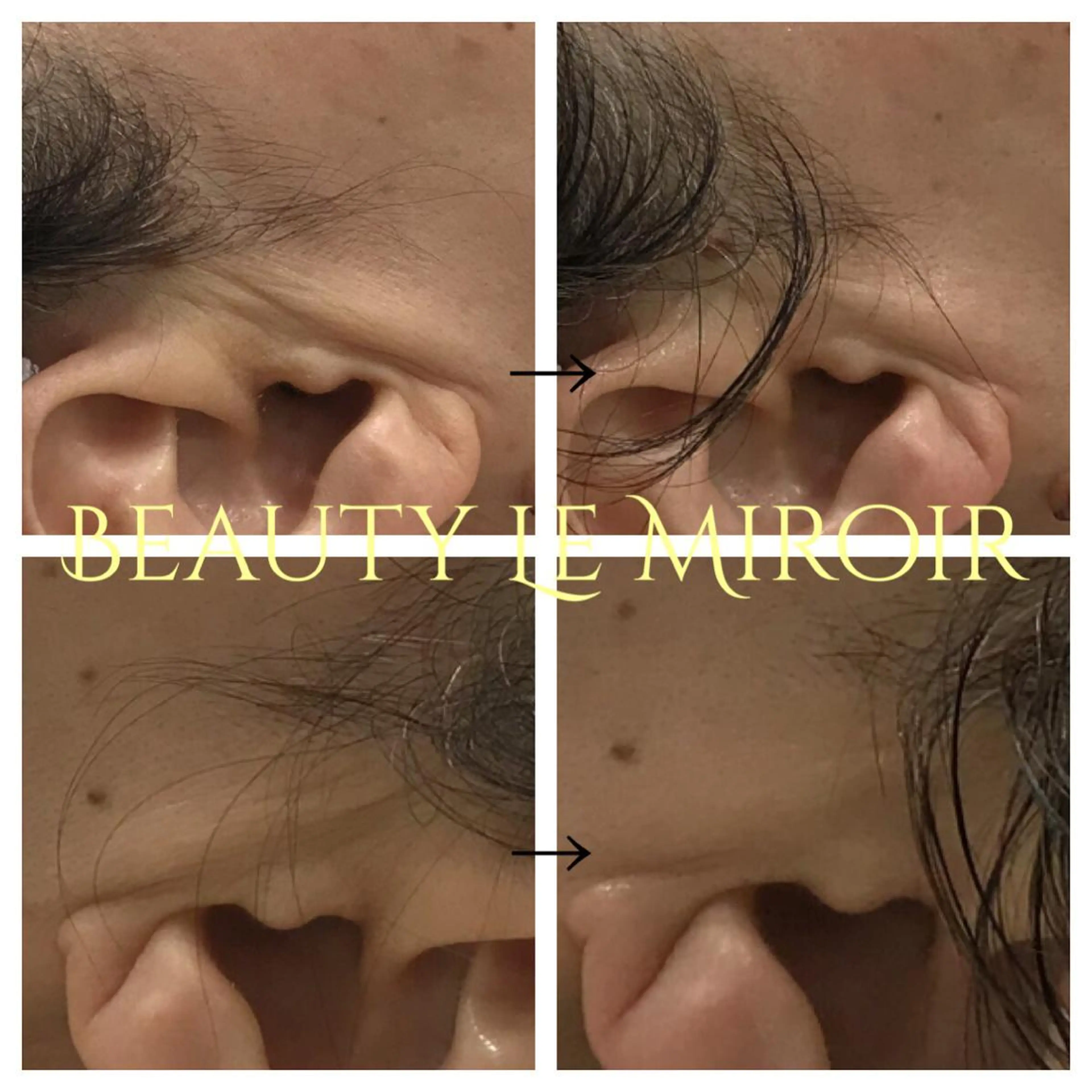 ビューティー ミロワールのエステ・リラクイメージ