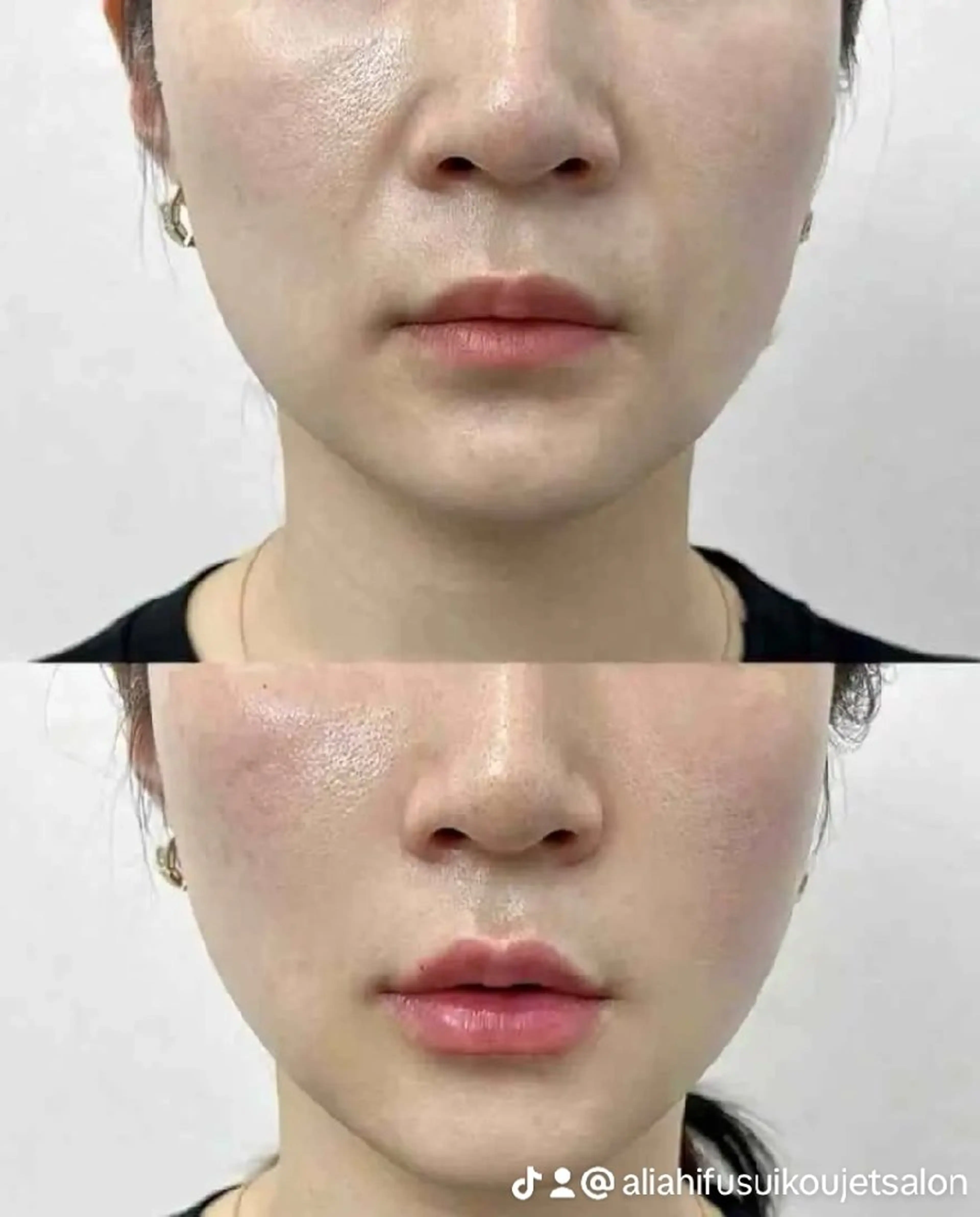 マツエク・マツパ 結婚式・ブライダル aliaハイフ&水光ジェットサロン所属・aliaハーブ水光店 エステティシャン募集のエステ・リラクイメージ