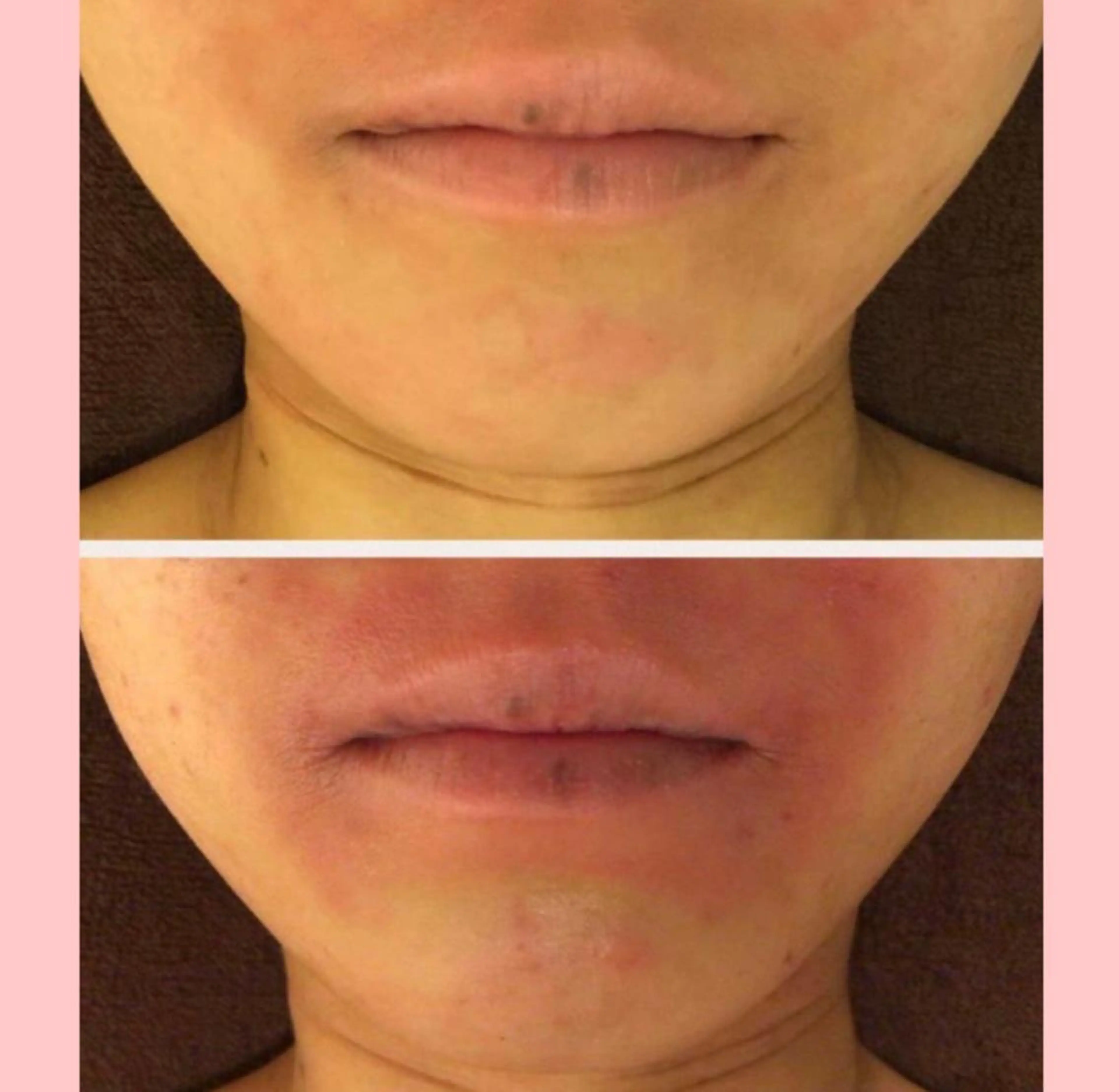 夏までに肌荒れ卒業 するサロン🌻のエステ・リラクイメージ